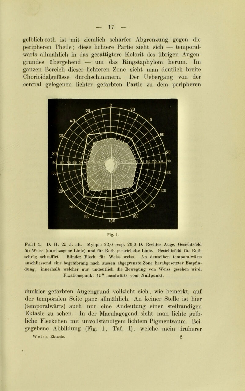 gelblich-roth ist mit ziemlich scharfer Abgrenzung gegen die peripheren Theile; diese lichtere Partie zieht sich — temporal- wärts allmählich in das gesättigtere Kolorit des übrigen Augen- grundes übergehend — um das Ringstaphylom herum. Im ganzen Bereich dieser lichteren Zone sieht man deutlich breite Chorioidalgefässe durch schimmern. Der Uebergang von der central gelegenen lichter gefärbten Partie zu dem peripheren Fig. 1. Fall 1, D. H. 25 J. alt. Myopie 22,0 resp. 20,0 D. Rechtes Auge. Gesichtsfeld für Weiss (durchzogene Linie) und für Roth gestrichelte Linie. Gesichtsfeld für Roth schräg schraöirt. Blinder Fleck für Weiss weiss. An denselben teraporahvärts anschliessend eine bogenförmig nach aussen abgegrenzte Zone herabgesetzter Empfin- dung, innerhalb welcher nur undeutlich die Bewegung von Weiss gesehen wird. Fixationspunkt 15° nasalwärts vom Nullpunkt. dunkler gefärbten Augengrund vollzieht sich, wie bemerkt, auf der temporalen Seite ganz allmählich. An keiner Stelle ist hier (temporalwärts) auch nur eine Andeutung einer steilrandigen Ektasie zu sehen. In der Maculagegend sieht man lichte gelb- liche Fleckchen mit unvollständigem lichtem Pigmentsaum. Bei- gegebene Abbildung (Fig. 1, Taf. I), welche mein früherer Weiss, Ektasie. 2