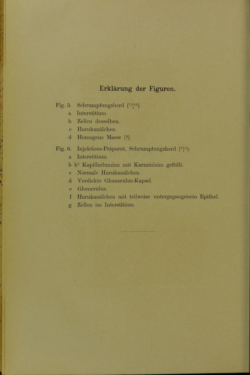 Fig. 5. Schrumpfungsherd (^^). a Interstitium. b Zellen desselben, c Harnkanälchen. d Homogene Masse (?). Fig. 6. Injektions-Präparat, Schrumpfungsherd {—). a Interstitium. b b^ Kapillarlumina mit Karminleim gefüllt. c Normale Harnkanälchen. d Verdickte Glomerulus-Kapsel. e Glomerulus. f Harnkanälchen mit teilweise untergegangenem Epithel, g Zellen im Interstitium.