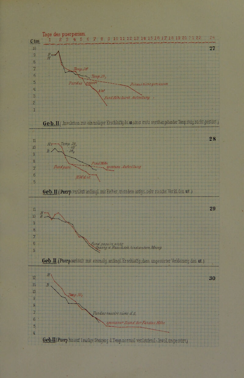 Gob.Ili Jnvctoonmu einmaliger Erschläffjis.ufcsönsi trotz vorüber gehender Terrip.sreig bxcIit gestört) Geb ll(Puerp.verläuftanfängimitfie'ber,fetztearags.sehr rasche VerKLcl.es ul j Geb-H.fPuprp.yerläuft mit einraalg.aniangl.Erschiaffg;dann ungesicrterVerKleinerg des ut.) t2 u LO 8 7 6 5 a vassirr nicAr d.S. spontaner Stand derFundus Jfohe GebJI( .Puerp .bis auf Imalige Sfeigerg. d.Tfmnp.norraal verlautende Jnvol.tmge stört.) 30
