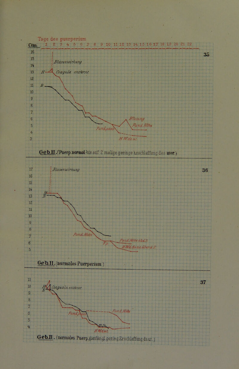 Clm. 1 2 3 <z 5 6 7 6 9 10 11 12 13 K 15 16 17 16 19 20 21 22 GebJI .fPuerp.normal-'bis auf 2 malige geringe trscHaffuig,des urer.) Geb.ll. (normales Puerperium) 11 10 9 5 7 6 5 ffxj] Coaquala. entfernt Fun ’f tfAA*) jtmui. GebJI. (normales Puerp.)(anfangi gerjrig.Erschlaffungds.ur. 37 )