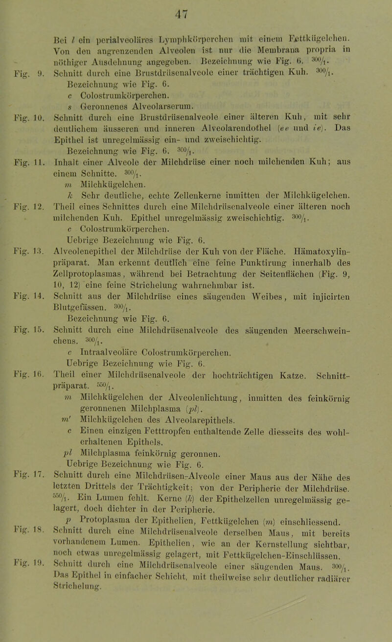 Bei l ein perialveoliires Lymphkörperchen mit einem Fettkügelchen. Von den angrenzenden Alveolen ist nur die Membrana propria in nöthiger Ausdehnung angegeben. Bezeichnung wie Fig. (>. m/\- Fig. 9. Schnitt durch eine Brustdriisenalveole einer trächtigen Kuh. W/t. Bezeichnung wie Fig. 6. c Colostrumkörperchen. s Geronnenes Alveolarserum. Fig. 10. Schnitt durch eine Brustdrüsenalveole einer älteren Kuh, mit sehr deutlichem äusseren und inneren Alvcolarendothel [ee und ie). Das Epithel ist unregelmässig ein- und zweischichtig. Bezeichnung wie Fig. 6. 8oo/t. Fig. 11. Inhalt einer Alveole der Milchdrüse einer noch milchenden Kuh; aus einem Schnitte. 300/i. m Milchkügelchen. k Sehr deutliche, echte Zellenkerne inmitten der Milchkügelchen. Fig. 12. Theil eines Schnittes durch eine Milchdrüsenalveole einer älteren noch milchenden Kuh. Epithel unregelmässig zweischichtig. 300/t. c Colostrumkörperchen. Uebrige Bezeichnung wie Fig. 6. Fig. 13. Alveolenepithel der Milchdrüse der Kuh von der Fläche. Hämatoxylin- präparat. Man erkennt deutlich eine feine Punktirung innerhalb des Zellprotoplasmas, während bei Betrachtung der Seitenflächen (Fig. 9, 10, 12) eine feine Strichelung wahrnehmbar ist. Fig. 14. Schnitt aus der Milchdrüse eines säugenden Weibes, mit injicirteu Blutgefässen. 300/1. Bezeichnung wie Fig. 6. Fig. 15. Schnitt durch eine Milchdrüsenalveole des säugenden Meerschwein- chens. 300/i. c Intraalveoläre Colostrumkörperchen. Uebrige Bezeichnung wie Fig. 6. Fig. 16. Theil einer Milchdriisenalveole der hochträchtigen Katze. Schnitt- präparat. 550/|. ?n Milchkügelchen der Alveolenlichtung, inmitten des feinkörnig geronnenen Milchplasma [pl). m' Milchkügelchen des Alveolarepithels. c Einen einzigen Fetttropfen enthaltende Zelle diesseits des wohl- erhaltenen Epithels. pl Milchplasma feinkörnig geronnen. Uebrige Bezeichnung wie Fig. 6. Fig. 17. Schnitt durch eine Milchdriisen-Alveole einer Maus aus der Nähe des letzten Drittels der Trächtigkeit; von der Peripherie der Milchdrüse. •”/i. Ein Lumen fehlt. Kerne (k) der Epithelzellen unregelmässig ge- lagert, doch dichter in der Peripherie. P Protoplasma der Epithelien, Fettkügelchen (m) einschliessend. Fig. 18. Schnitt durch eine Milchdriisenalveole derselben Maus, mit bereits voihandcnem Lumen. Epithelien, wie an der Kernstellung sichtbar, no°b etwas unregelmässig gelagert, mit Fettkügelchen-Einschlüssen. Iig. l.t. Schnitt durch eine Milchdriisenalveole einer säugenden Maus. 30O/(, Das Epithel in einfacher Schicht, mit theilweise sehr deutlicher radiärer Strichelung.