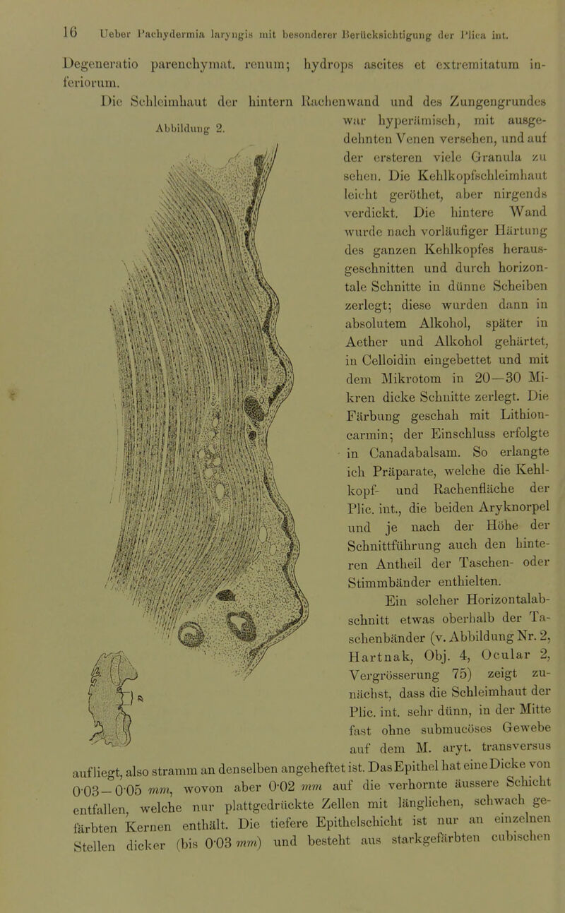 *, ■' Degeneratio pareucliymat. renum; hydrops ascites et extrernitatura in- feriorum. Die Sehlcimhaut der hinterii Rachenwand und des Zungengrundes Abbildung-2. %Perilmisch, mit ausge- dehnteu Venen versehen, und auf der ersteren viele Granula zu seheii. Die Kehlkopfscbleimhaut leicht gerOthot, aber nirgends verdickt. Die hintere Wand wiirdc nach vorlilufiger Hartung des ganzen Kehlkopfes heraus- geschnitten und durch horizon- zerlegt; diese warden dann in absolutem Alkohol, spater in Aether und Alkohol gehiirtet, in Celloidin eingebettet und mit dem Mikrotora in 20—30 Mi- kren dicke Schnitte zerlegt. Die Fiirbung geschah mit Lithion- carmin-, der Einschluss erfolgte in Canadabalsam. So erlangte ich Priiparate, welche die Kehl- kopf- und Rachenfliiche der Flic, int., die beiden Aryknorpel und je nach der Hohe der Schnittfiihrung auch den hinte- ren Antheil der Taschen- oder Stimmbander enthielten. Ein solcher Horizontalab- schnitt etwas oberhalb der Ta- schenbiinder (v. Abbildung Nr. 2, Hartnak, Obj. 4, Ocular 2, Vergrosserung 75) zeigt zu- nachst, dass die Schleimhaut der Plic. int. sehr diinn, in der Mitte fast ohne submucoses Gewebe auf dem M. aryt. transversus auf liegt, also stramm an denselben angeheftet ist. DasEpithel hat eine Dicke von 0-03-0-05 mm, wovon aber 0-02 mm auf die verhornte aussere Schicht entfallen welche nur plattgedriickte Zellen mit liingUchen, schwach ge- farbten Kernen enthiilt. Die tiefere Epithelschicht ist nur an cmzelnen Stellen dicker (bis 0-03 mm) und besteht aus starkgefarbten cubisclien