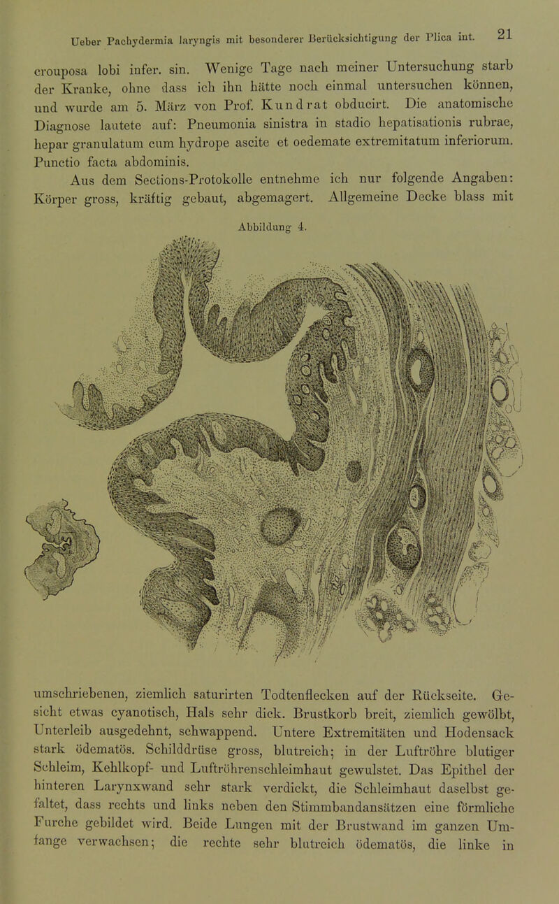 crouposa lobi infer, sin. Wenige Tage uach meiner Untersuchung starb der Kranke, ohne dass ich ihn hiitte noch einmal untersucben konnen, und wurde am 5. Miirz von Prof. Kundrat obducirt. Die anatomiscbe Diagnose lautete auf: Pneumonia sinistra in stadio bepatisationis rubrae, hepar granulatum cum bydrope ascite et oedemate extremitatum inferiorum. Punctio facta abdominis. Aus dem Seclions-Protokolle entnebme icb nur folgende Angaben: Korper gross, kraftig gebaut, abgemagert. xiUgemeine Decke blass mit Abbildung 4. umscbriebenen, ziemlicb saturirten Todtenflecken auf der Riickseite. Ge- sicbt etwas cyanotiscb, Hals sebr dick. Brustkorb breit, ziemlicb gewolbt, Unterleib ausgedebnt, scbwappend. Untere Extremitaten und Hodensack stark odematos. Scbilddriise gross, blutreicb; in der Luftrobre blatiger Scbleim, Keblkopf- und Luftrohrenscbleimhaut gewulstet. Das Epitbel der binteren Larynxwand sebr stark verdickt, die Scbleimbaut daselbst ge- faltet, dass recbts und links neben den Stimmbandansatzen eine formlicbc Furche gebildet wird. Beide Lungen mit der Brustwand im ganzen Um- fange verwachsen; die recbte sebr blutreicb odematos, die linke in