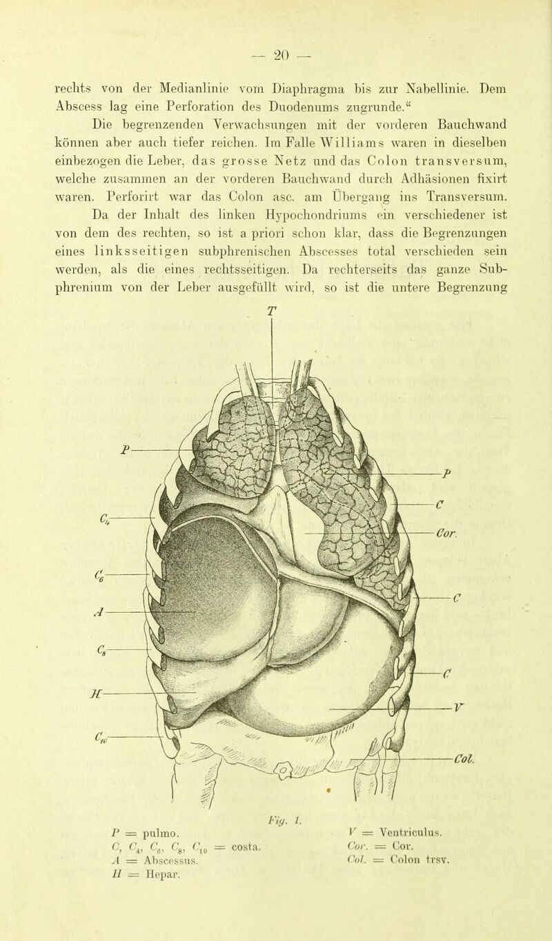 rechts von der Medianlinie vom Diaphragma bis zur Nabellinie. Dem Abscess lag eine Perforation des Duodenums zugrunde. Die begrenzenden Verwachsungen mit der vorderen Bauchwand können aber auch tiefer reichen. Im Falle Williams waren in dieselben einbezogen die Leber, das grosse Netz und das Colon transversum, welche zusammen an der vorderen Bauchwand durch Adhäsionen fixirt waren. Perforirt war das Colon asc. am Übergang ins Transversum. Da der Inhalt des linken Hypochondriums ein verschiedener ist von dem des rechten, so ist a priori schon klar, dass die Begrenzungen eines linksseitigen subphrenischen Abscesses total verschieden sein werden, als die eines rechtsseitigen. Da rechterseits das ganze Sub- phrenium von der Leber ausgefüllt wird, so ist die untere Begrenzung T pulmo. A = Abscpssus. H = Hepar. /<•/>/. /. — Costa. I' = Vciitriculu-;. Cor. = Cor. Col. = Colon tvsv.