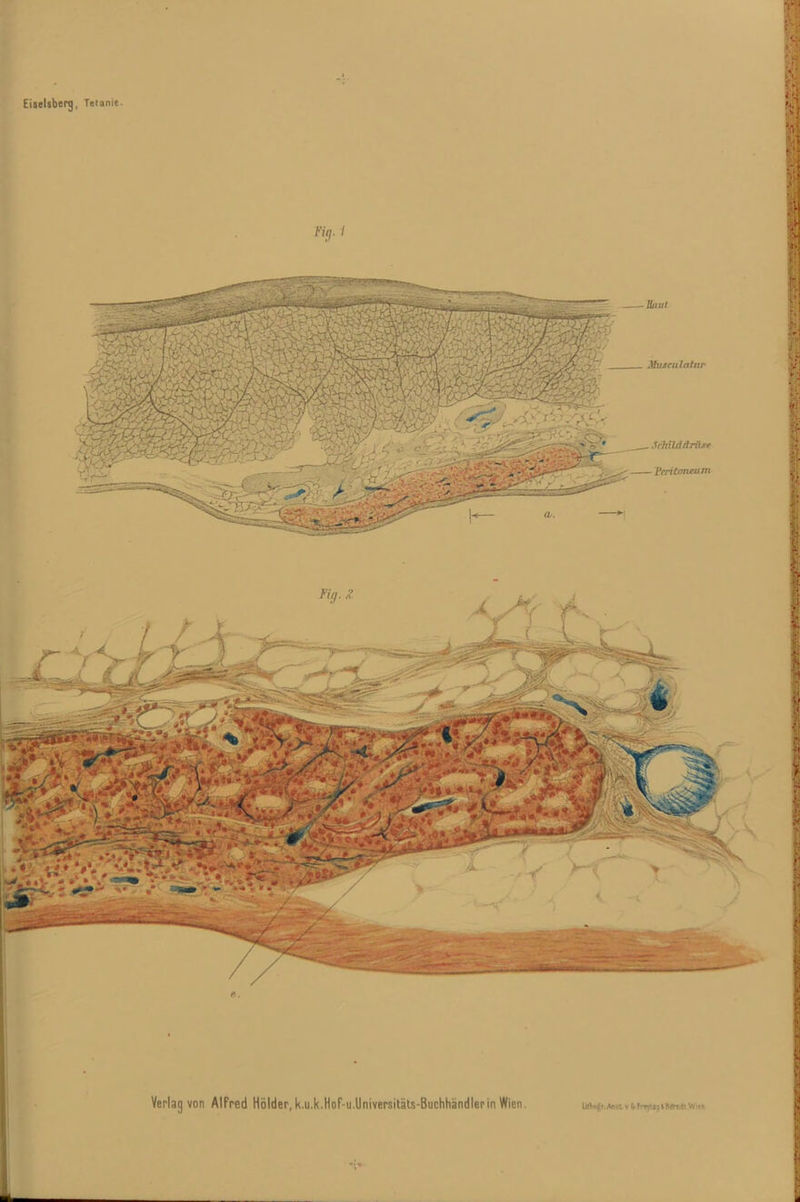 Eiseisberg, Teianie.
