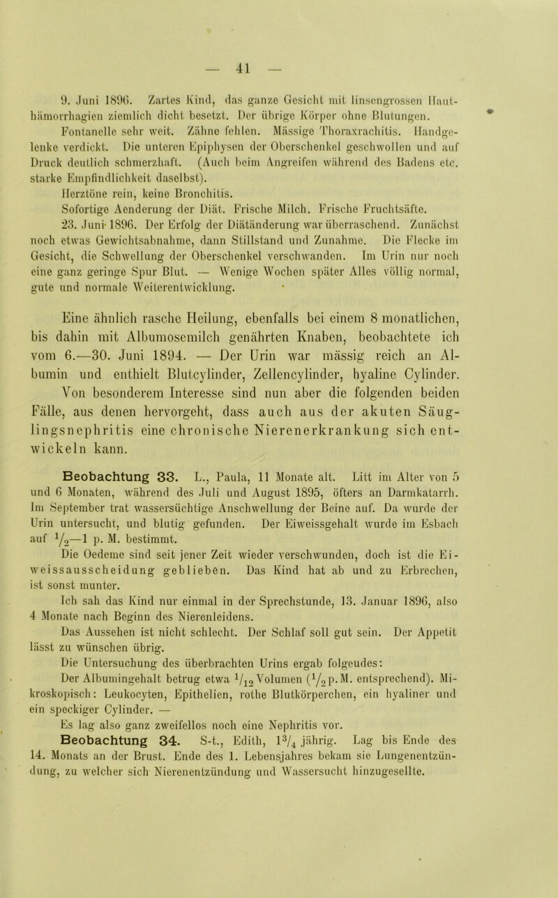 9. Juni IS9G. Zartes Kind, das ganze Gesicht mit linsongrossen Ifant- hamoiTliagien ziemlich dicht besetzt. Der übrige Körper ohne I3hi(ungen. Fontanelle sehr weit. Zähne fehlen. Massige Thoraxrachitis. Handge- lenke verdickt. Die unteren Epiphysen der Oberschenkel geschwollen und auf Druck deutlich schmerzhaft. (Auch beim Angreifen während des Badens etc. starke Empfindlichkeit daselbst). Herztöne rein, keine Bronchitis. Sofortige Aenderung der Diät. Frische Milch. Frische Fruchtsäfte. 23. JunM896. Der Erfolg der Diätänderung war überraschend. Zunächst noch etwas Gewichtsabnahme, dann Stillstand und Zunahme. Die Flecke im Gesicht, die Schwellung der Oberschenkel verschwanden. Im Urin nur noch eine ganz geringe Spur Blut. — Wenige Wochen später Alles völlig normal, gute und normale Weiterentwicklung. Eine ähnlich rasche Heilung, ebenfalls bei einem 8 monatlichen, bis dahin mit Albumosemilch genährten Knaben, beobachtete ich vom 6.—30. Juni 1894. — Der Urin v^ar massig reich an Al- bumin und enthielt Blutcylinder, Zellencylinder, hyaline Cylinder. Von besonderem Interesse sind nun aber die folgenden beiden Fälle, aus denen hervorgeht, dass auch aus der akuten Säug- lingsnephritis eine chronische Nierenerkrankung sich ent- wickeln kann. Beobachtung 33. L., Paula, 11 Monate alt. Litt im Alter von 5 und 6 Monaten, während des Juli und August 1895, öfters an Darnikatarrh. Im September trat wassersüchtige Anschwellung der Beine auf. Da wurde der Urin untersucht, und blutig gefunden. Der Eiweissgehalt wurde im Esbach auf Y2—1 p. M. bestimmt. Die Oedeme sind seit jener Zeit wieder verschwunden, doch ist die Ei- weissausscheidung geblieben. Das Kind hat ab und zu Erbrechen, ist sonst munter. Ich sah das Kind nur einmal in der Sprechstunde, 13. Januar 1896, also 4 Monate nach Beginn des Nierenleidens. Das Aussehen ist nicht schlecht. Der Schlaf soll gut sein. Der Appetit lässt zu wünschen übrig. Die Untersuchung des überbrachten Urins ergab folgendes: Der Albuniingehalt betrug etwa Volumen (Yc>p.M. entsprechend). Mi- kroskopisch: Leukocyten, Epithelien, rothe Blutkörperchen, ein hyaliner und ein speckiger Cylinder. — Es lag also ganz zweifellos noch eine Nephritis vor. Beobachtung 34. S-t., Edith, D/4 jäärig. Lag bis Ende des 14. Monats an der Brust. Ende des 1. Lebensjahres bekam sie Lungenentzün- dung, zu welcher sich Nierenentzündung und Wassersucht hinzugesellte.