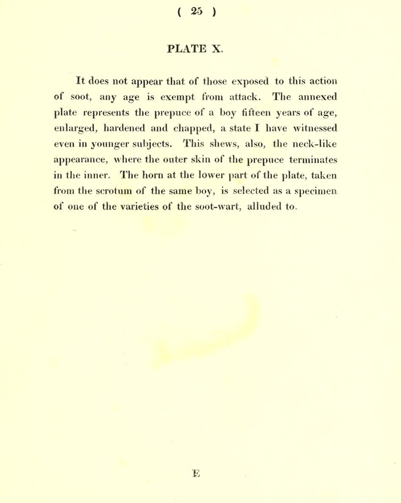 ( 25 ) PLATE X. It does not appear that of those exposed to this action of soot, any age is exempt froni attack. The annexed plate represents tlie prepuce of a boy fifteen years of age, enlarged, hardened and cliapped, a state I have witnessed even in younger siibjects. This shews, also, the neck-like appearance, where the outer skin of the prepuce terminates in the inner. The horn at the lower ])art of the plate, taken from the scrotum of the same boy, is selected as a speeimen of one of the varieties of the soot-wart, aliuded to. E