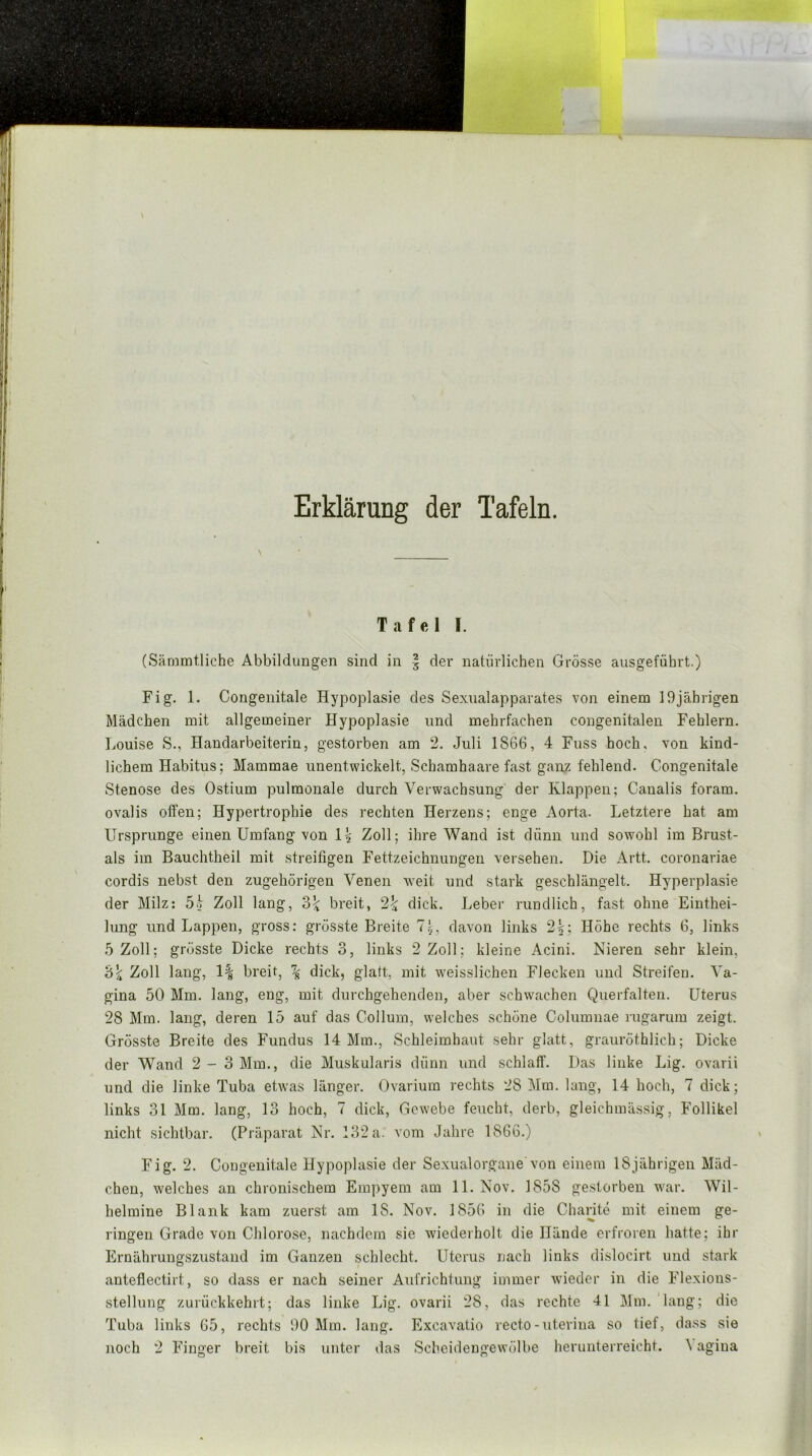 Erklärung der Tafeln. Tafel I. (SänDintliche Abbildungen sind in § der natürlichen Grösse ausgeführt.) Fig. 1. Congenitale Hypoplasie des Sexualapparates von einem 19jährigen Mädchen mit allgemeiner Hypoplasie und mehrfachen congenitalen Fehlern. Louise S., Handarbeiterin, gestorben am 2. Juli 1866, 4 Fuss hoch, von kind- lichem Habitus; Mammae unentwickelt, Schamhaare fast ganz fehlend. Congenitale Stenose des Ostium pulmonale durch Verwachsung der Klappen; Canalis foram. ovalis offen; Hypertrophie des rechten Herzens; enge Aorta. Letztere hat am Ursprünge einen Umfang von Zoll; ihre Wand ist dünn und sowohl im Brust- als im Bauchtheil mit streifigen Fettzeichnungen versehen. Die Artt. coronariae cordis nebst den zugehörigen Venen weit und stark geschlängelt. Hyperplasie der Milz: 5h Zoll lang, breit, 2^ dick. Leber rundlich, fast ohne Einthei- lung und Lappen, gross: grösste Breite Tj, davon links 2|; Höhe rechts 6, links 5 Zoll; grösste Dicke rechts 3, links 2 Zoll; kleine Acini. Nieren sehr klein, 'ö\ Zoll lang, 1§ breit, \ dick, glatt, mit w'eisslichen Flecken und Streifen. Va- gina 50 Mm. lang, eng, mit durchgehenden, aber schwachen Querfalten. Uterus 28 Mm. lang, deren 15 auf das Collum, welches schöne Columuae rugarum zeigt. Grösste Breite des Fundus 14 Mm., Schleimhaut sehr glatt, grauröthlich; Dicke der Wand 2-3 Mm., die Muskularis dünn und schlaff. Das linke Lig. ovarii und die linke Tuba etwas länger. Ovarium rechts 28 Mm. lang, 14 hoch, 7 dick; links 31 Mm. lang, 13 hoch, 7 dick, Gewebe feucht, derb, gleichmässig, Follikel nicht sichtbar. (Präparat Nr. 132 a. vom Jahre 1866.) Fig. 2. Congenitale Hypoplasie der Sexualorgane von einem 18jährigen Mäd- chen, welches an chronischem Ein])yem am 11. Nov. 1858 gestorben war. Wil- helmine Blank kam zuerst am 18. Nov. 1856 in die Charite mit einem ge- ringen Grade von Chlorose, nachdem sie wiederholt die Hände erfroren hatte; ihr Ernährungszustand im Ganzen schlecht. Uterus nach links dislocirt und stark anteflectirt, so dass er nach seiner Aufrichtung iuimer wieder in die Flexious- stellung zurückkehrt; das linke Lig. ovarii 28, das rechte 41 Mm.'lang; die Tuba links 65, rechts 90 Mm. lang. Excavatio recto-uterina so tief, dass sie