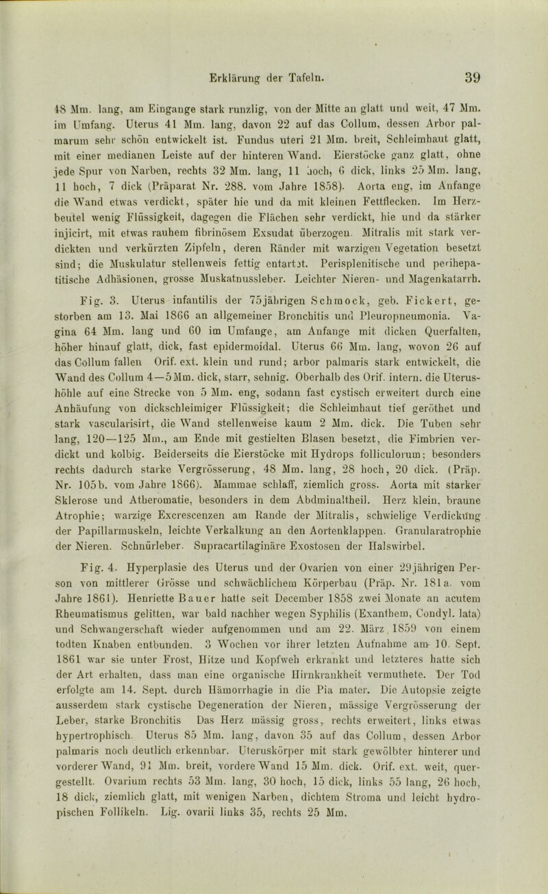 48 Mm. lang, am Eingänge stark runzlig, von der Mitte an glatt und weit, 47 Mm. im Umfang. Uterus 41 Mm. lang, davon 22 auf das Collum, dessen Arbor pal- marum sehr schon entwickelt ist. Fundus uteri 21 Mm. breit, Schleimhaut glatt, mit einer medianen Leiste auf der hinteren Wand. Eierstöcke ganz glatt, ohne jede Spur von Narben, rechts 32 Mm. lang, 11 hoch, G dick, links 25 Mm. lang, 11 hoch, 7 dick (Präparat Nr. 288. vom Jahre 1858). Aorta eng, im Anfänge die Wand etwas verdickt, später hie und da mit kleinen Fettflecken. Im Herz- beutel wenig Flüssigkeit, dagegen die Flächen sehr verdickt, hie und da stärker injicirt, mit etwas rauhem fibrinösem Exsudat überzogen. Mitralis mit stark ver- dickten und verkürzten Zipfeln, deren Ränder mit warzigen Vegetation besetzt sind; die Muskulatur stellenweis fettig entartet. Perisplenitische und perihepa- titische Adhäsionen, grosse Muskatnussleber. Leichter Nieren- und Magenkatarrh. Fig. 3. Uterus infantilis der 75jährigen Schmock, geh. Fickert, ge- storben am 13. Mai 1866 an allgemeiner Bronchitis und Pleuropneumonia. Va- gina 64 Mm. lang und 60 im Umfange, am Anfänge mit dicken Querfalten, höher hinauf glatt, dick, fast epidermoidal. Uterus 66 Mm. lang, wovon 26 auf das Collum fallen Orif. ext. klein und rund; arbor palmaris stark entwickelt, die Wand des Collum 4—5 Mm. dick, starr, sehnig. Oberhalb des Orif. intern, die Uterus- höhle auf eine Strecke von 5 Mm. eng, sodann fast cystisch erweitert durch eine Anhäufung von dickschleimiger Flüssigkeit; die Schleimhaut tief geröthet und stark vascularisirt, die Wand stellenweise kaum 2 Mm. dick. Die Tuben sehr lang, 120—125 Mm., am Ende mit gestielten Blasen besetzt, die Fimbrien ver- dickt und kolbig. Beiderseits die Eierstöcke mit Hydrops folliculorum; besonders rechts dadurch starke Vergrösserung, 48 Mm. lang, 28 hoch, 20 dick. (Präp. Nr. 105b. vom Jahre 1866). Mammae schlaff, ziemlich gross. Aorta mit starker Sklerose und Atheromatie, besonders in dem Abdminaltheil. Herz klein, braune Atrophie; warzige Excresceuzen am Rande der Mitralis, schwielige Verdickilng der Papillarmuskeln, leichte Verkalkung au den Aortenklappen. Granularatrophie der Nieren. Schnürleber. Supracartilaginäre Exostosen der Halswirbel. Fig. 4. Hyperplasie des Uterus und der Ovarien von einer 29jährigen Per- son von mittlerer Grösse und schwächlichem Körperbau (Präp. Nr. 181a. vom Jahre 1861). Henriette Bauer hatte seit December 1858 zwei Monate an acutem Rheumatismus gelitten, war bald nachher wegen Syphilis (Exanthem, Condyl. lata) und Schwangerschaft wieder aufgenommen und am 22. März 1859 von einem todten Knaben entbunden. 3 Wochen vor ihrer letzten Aufnahme am- 10. Sept. 1861 war sie unter Frost, Hitze und Kopfweh erkrankt und letzteres hatte sich der Art erhalten, dass man eine organische Hirnkrankheit vermuthete. Der Tod erfolgte am 14. Sept. durch Hämorrhagie in die Pia mater. Die Autopsie zeigte ausserdem stark cystische Degeneration der Nieren, massige Vergrösserung der Leber, starke Bronchitis Das Herz massig gross,, rechts erweitert, links etwas hypertrophisch. Uterus 85 Mm. lang, davon 35 auf das Collum, dessen Arbor palmaris noch deutlich erkennbar. Uteruskörper mit stark gewölbter hinterer und vorderer Wand, 91 Mm. breit, vordere Wand 15 Mm. dick. Orif. ext. weit, quer- gestellt. Ovarium rechts 53 Mm. lang, 30 hoch, 15 dick, links 55 lang, 26 hoch, 18 diele, ziemlich glatt, mit wenigen Narben, dichtem Stroma und leicht hydro- pischen Follikeln. Lig. ovarii links 35, rechts 25 Mm.