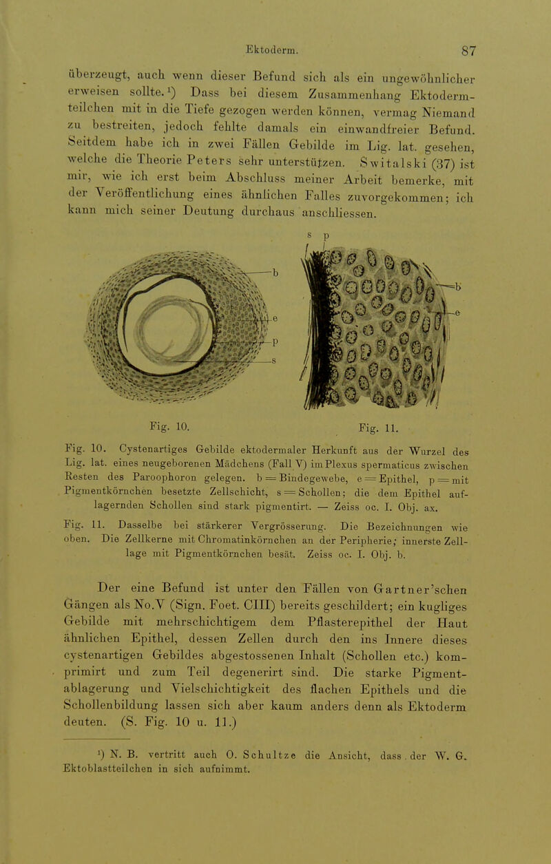 überzeugt, auch wenn dieser Befund sich als ein ungewöhnlicher erweisen sollte, i) Dass bei diesem Zusammenhang Ektoderm- teilchen mit in die Tiefe gezogen werden können, vermag Niemand zu bestreiten, jedoch fehlte damals ein einwandfreier Befund. Seitdem habe ich in zwei Fällen Gebilde im Lig. lat. gesehen, welche die Theorie Peters sehr unterstützen. Switalski (37) ist mir, wie ich erst beim Abschluss meiner Arbeit bemerke, mit der Veröffentlichung eines ähnlichen Falles zuvorgekommen; ich kann mich seiner Deutung durchaus anschliessen. s p Fig. 10. Fig. 11. Fig. 10. Cystenartiges Gebilde ektodermaler Herkunft aus der Wurzel des Lig. lat. eines neugeborenen Mädchens (Fall V) im Plexus spermaticus zwischen Eesten des Paroophoron gelegen, b = Bindegewebe, e = Epithel, p = niit Pigmentkörnchen besetzte Zellschicht, s = Schollen; die dem Epithel auf- lagernden Schollen sind stark pigmentirt. — Zeiss oc. I. Obj. ax. Fig. 11. Dasselbe bei stärkerer Vergrösserung. Die Bezeichnungen wie oben. Die Zellkerne mit Chromatinkörnchen an der Peripherie; innerste Zell- lage mit Pigmentkörnchen besät. Zeiss oc. I. Obj. b. Der eine Befund ist unter den Fällen von Gartner'schen Gängen als No.Y (Sign. Foet. CHI) bereits geschildert; ein kugliges Gebilde mit mehrschichtigem dem Pflasterepithel der Haut ähnlichen Epithel, dessen Zellen durch den ins Innere dieses cystenai-tigen Gebildes abgestossenen Inhalt (Schollen etc.) kom- primirt und zum Teil degenerirt sind. Die starke Pigment- ablagerung und Vielschichtigkeit des flachen Epithels und die Schollenbildung lassen sich aber kaum anders denn als Ektoderm deuten. (S. Fig. 10 u. 11.) 1) N. B. vertritt auch 0. Schultze die Ansicht, dass . der W. G. Ektoblastteilchen in sich aufnimmt.