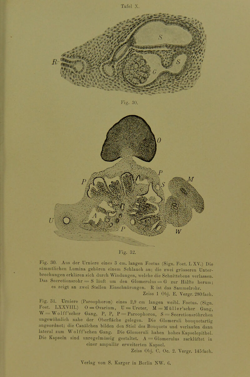 Tafel X. Fig. 32. Fig. 30. Aus der Urniere eines 3 cm. langen Foetus (Sign. Foet. L XV.) Die sümmtlichen Lumina gehören einem Schlauch an; die zwei grösseren Unter- brechungen erklären sich durch Windungen, welche die Schnittehene verlassen. Das Secretionsrohr = S läuft um den Glomerulus = G zur Hälfte herum; es zeigt an zwei Stellen Einschnürungen. R ist das Sammelrohr. Zeiss 1 Obj. E. Vergr. 280fach. Fig. 31. Urniere (Paroophoron) eines 2,9 cm langen weibl. Foetus. (Sign. Foet. LXXVIII.) 0 = Oyarium, U = Ureter, M = M üller'scher Gang, W = WoIff'scher Gang, P, P, P = Paroophoron, S = Secretionsrölirchen ungewöhnlich nahe der Oberfläche gelegen. Die Glomeruli bouquetartig angeordnet; die Canälchen bilden den Stiel des Bouqucts und verlaufen dann lateral zum Wolff'schen Gang. Die Glomeruli haben hohes Kapselepithel. Die Kapseln sind unregelmässig gestaltet. A = Glomerulus zorldüftet in einer ampullär erweiterten Kapsel. Zeiss Obj. C. Oc. 2. Vergr. 1-15fach. Verlag von S. Karger in Berlin NW. 6.