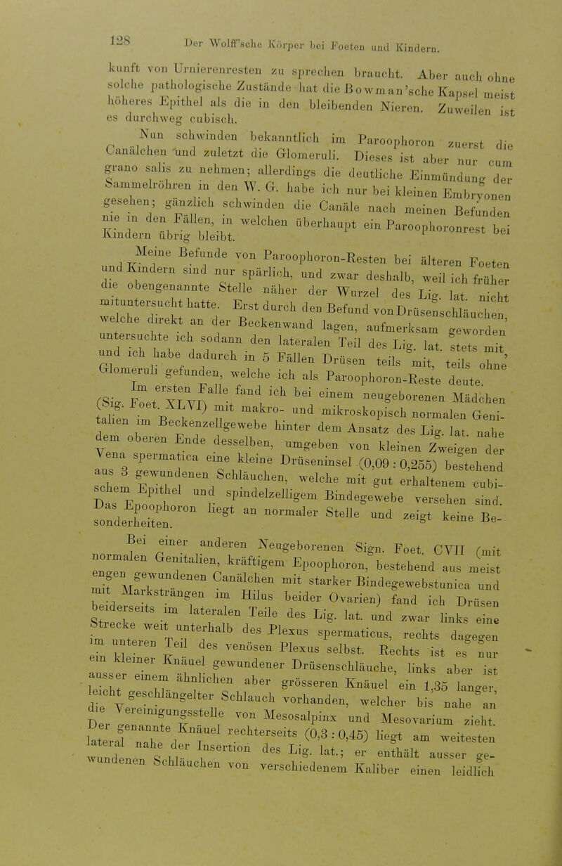 kunft von Urnierenresten zu sj.rechen braucht. Aber auch ohne solche pathologische Zustände hat die ßowman'sehe Kapsel meist höheres Epithel als die in den bleibenden Nieren. Zuweilen ist es durchweg cubisch. Nun sclnviuden bekanntllcl, im Paroophovon zuerst die Canalchen -und zuletzt die Glomeruli. Dieses ist aber nur cum grano sal,s zu nel.men; allerdings die deutliche Einmündung der Sammelrohren ,n den W. G. habe ich nur bei kleinen Embryonen gesehen; gtazhcl, schwinden die Canäle nach meinen Bef nden zne ,n den Fallen .n welchen überhaupt ein Paroophoronrest bei iundern übrig bleibt. ^i- Meine Befunde von Paroophoron-Resten bei älteren Foeter, undlündern smd nur spärlich, und zwar deshalb, weil ich fr^er d.e obengenannte Stelle näher der Wurzel des Lig. lat , ch m, untersucht hatte. Erst durch den Befund vonDrüsensehHnchen welche .reht an der Beckenwand lagen, aufmerksam tZa- und .ch habe dadurch m 5 Fällen Drüsen teils mit, teils ohne' Glomeruh gefunden welche ich als Paroophoron-Resie deute (Si. Fit™ /I ^■''^ neugeborenen Mädchen ir ■ ^'■/I) n'^'k™- und mikroskopisch normalen Geni- tahen .m Beckenzellgewebe hinter dem Ansatz des Lig. la, nahe dem oberen Ende desselben, umgeben von kleinen zl en der auHrrT Tn'°' Drüseninsel (0,09:0,255) beltehen Das E„„rl v T'''' Bindegewebe versehen sind. fonde^IeHen ™  ^^^^ «e- normatn C^l l,''™. .^^S'»-™ «ig- Foet. CVII (mit normalen Genrtahen, kräft.gem Epoophoron, bestehend aus meist mifZkr ''^t';' B-legewebstuniL u^ m.t Markstrangen im Hrlus beider Ovarien) fand ich Drüsen berderserts rm lateralen Teile des Lig. lat. und zwar links e ne .mTnttrr'xT'f ^''^ ^P^™«-^' ^'^^'^ ''4 » 7n kl l ='''>^*- ist es Lr em kiemer Knäuel gewundener Drüsenschlänche, links aber ist au s« ernern ähnlichen aber grösseren Knäuel ein 1,36 kn. 1 .cht geschlängeltsr Schlauch vorhanden, welcher bi^ nahe °an' d,e Veremigungsstelle von Mesosalpinx und Mesovarium zieht wund neTl ^''«^ '^^^^ -undenen Schlauchen von verschiedenem Kaliber einen leidHch