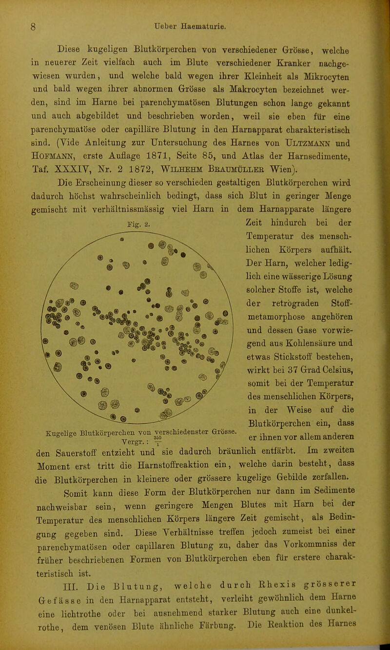 Diese kugeligen Blutkörperchen von verschiedener Grösse, welche in neuerer Zeit vielfach auch im Blute verschiedener Kranker nachge- wiesen wurden, und welche bald wegen ihrer Kleinheit als Mikrocyten und bald wegen ihrer abnormen Grösse als Makrocyten bezeichnet wer- den, sind im Harne bei parenchymatösen Blutungen schon lange gekannt und auch abgebildet und beschrieben worden, weil sie eben für eine parenchymatöse oder capilläre Blutung in den Harnapparat charakteristisch sind. (Yide Anleitung zur Untersuchung des Harnes von Ultzmann und Hofmann, erste Auflage 1871, Seite 85, und Atlas der Harnsedimente, Taf. XXXIV, Nr. 2 1872, WiLHEHM Beaumüllee Wien). Die Erscheinung dieser so verschieden gestaltigen Blutkörperchen wird dadurch höchst wahrscheinlich bedingt, dass sich Blut in geringer Menge gemischt mit verhältnissmässig viel Harn in dem Harnapparate längere Fig. 2. Zeit hindurch bei der Temperatur des mensch- lichen Körpers aufhält. Der Harn, welcher ledig- lich eine wässerige Lösung solcher Stoffe ist, welche der retrograden StofiF- metamorphose angehören und dessen Gase vorwie- gend aus Kohlensäure und etwas Stickstoff bestehen, wirkt bei 37 Grad Celsius, somit bei der Temperatur des menschlichen Körpers, der Weise auf die m Blutkörperchen ein, dass er ihnen vor allem anderen Kugelige Blutkörperclien von versoMedenster Grösse. Vergr.: dadurch bräunlich entfärbt. Im zweiten den Sauerstoff entzieht und sie Moment erst tritt die Harnstoffreaktion ein, welche darin besteht, dass die Blutkörperchen in kleinere oder grössere kugelige Gebilde zerfallen. Somit kann diese Form der Blutkörperchen nur dann im Sedimente nachweisbar sein, wenn geringere Mengen Blutes mit Harn bei der Temperatur des menschlichen Körpers längere Zeit gemischt, als Bedin- gung gegeben sind. Diese Verhältnisse treffen jedoch zumeist bei einer parenchymatösen oder capillaren Blutung zu, daher das Vorkommniss der früher beschriebenen Formen von Blutkörperchen eben für erstere charak- teristisch ist. III. Die Blutung, welche durch Ehexis grösserer Gefässe in den Harnapparat entsteht, verleiht gewöhnlich dem Harne lichtrothe oder bei ausnehmend starker Blutung auch eine dunkel- eine Tothe, dem venösen Blute ähnliche Färbung. Die Reaktion des Harnes