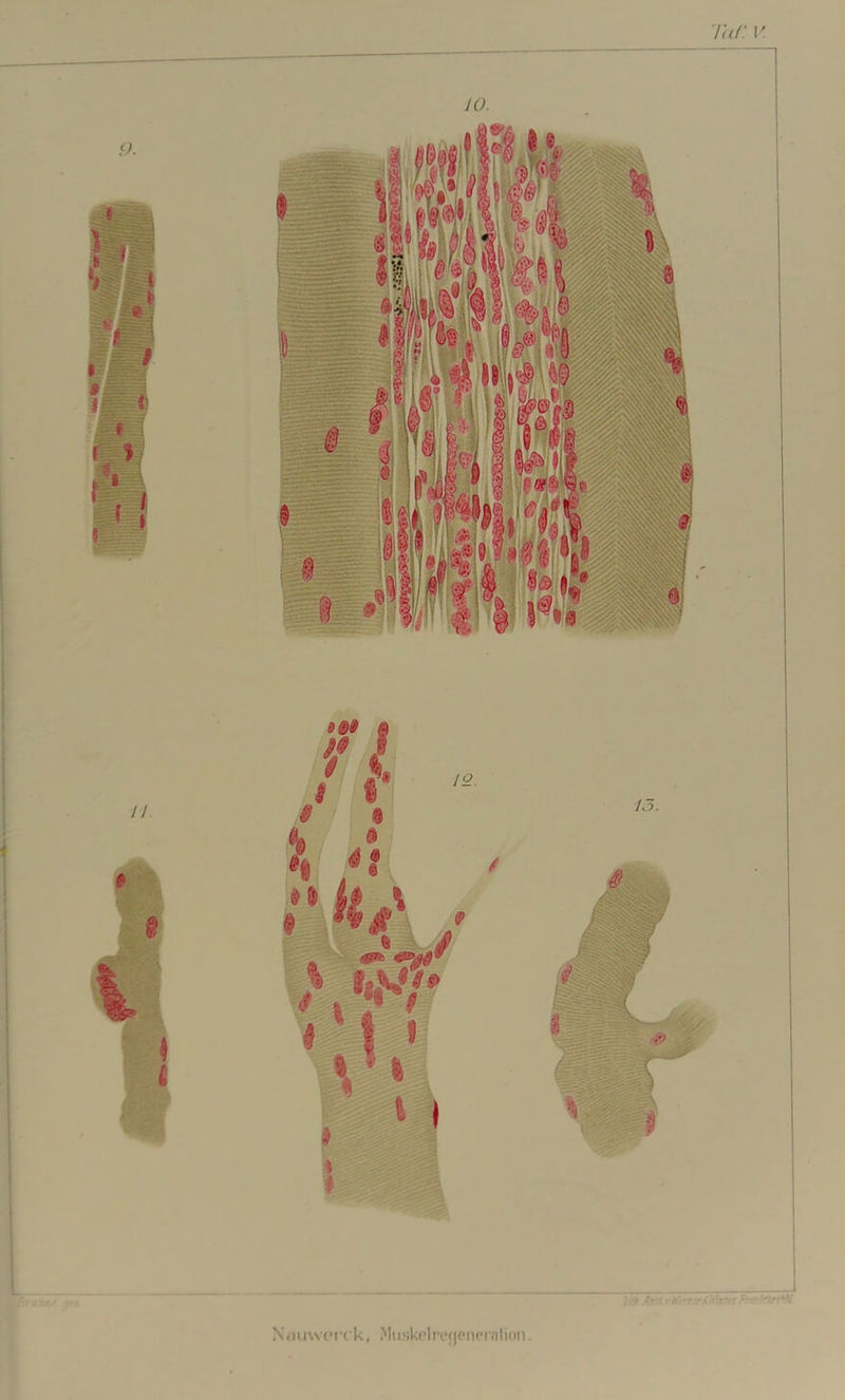 TaC V. Xauweirk, Miiskelmienrniiion