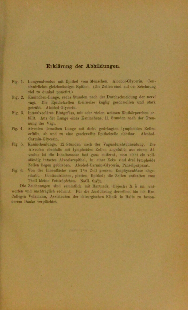 Erklärung der Abbildungen. Fig. 1. Lungenalveolus mit Epithel vom Menschen. Alcohol-Glycerin. Coti- tinuirliches gleichroässiges Epithel. (Die Zellen sind auf der Zeichnung viel zu dunkel punetirt.) Fig. 2. Kaninchen-Lunge, sechs Stunden nach der Durchschneidung der nervi vagi. Die Epithelzellen theilweise kuglig geschwollen und stark getrübt. Aicohol-GIyeerin. Fig. 3. Interalveolüres Blutgefäss, mit sehr vielen weissen Blutkörperchen er- füllt. Ans der Lunge eines Kaninchens, 11 Stunden nach der Tren- nung der Vagi. Fig. 4. Alveolen derselben Lunge mit dicht gedrängten lymphoiden Zellen erfüllt, ab und zu eine geschwellte Epithelzelle sichtbar. Aicohol- Carmin-Ülycerin. Fig. 5. Kaninchenlunge, 12 Stunden nach der Vagusdurchschneidung. Die Alveolen ebenfalls mit lymphoiden Zellen angefüllt; aus einem Al- veolus ist die Inhaltsmasse fast ganz entfernt, man sieht ein voll- ständig intactes Alveolarepitbel, in einer Ecke siud drei lymphoide Zellen liegen geblieben. Alcobol-Cartniu-Glycerin, 1‘inselpräparat. Fig ß. Von der Innenfläche einer 1'/* Zoll grossen Emphysenbla.se abge- schabt. Continuirlicbes, plattes, Epithel; die Zellen enthalten zum Theil kleine Fetttröpfchen. NaCl. 0,8*Vo. Die Zeichnungen sind sämmtlicb mit llartuack. Objectiv X a im. ent- worfen und nachträglich reducirt. Für die Ausführung derselben bin ich Hin. Oollegen Volkmann, Assistenten der chirurgischen Klinik in Halle zu beson- derem Danke verpflichtet.