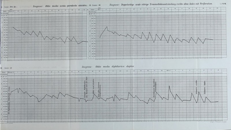 Same: /W. Ki: ISS*. Diagnose- Otitis media acuta puriüeiila sbüslra. n. X, 'cum-- in diiujnosc-- Doppelseitige acute eilricje TronuneUiölejieiüzündung.rechts ohne.Unks mit Peiforution. TafVI-VE. M. Same J/ Diagnose ■ OlUis media diphiherica diiplct n,iti,m Februar 6 R. P T. so SU) 91 l'eriagvJ F! Bergmann, Wiesbaden .