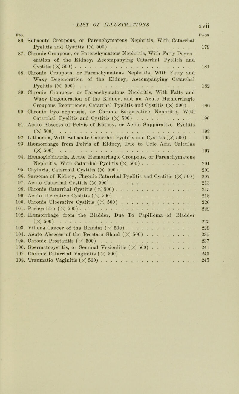 Fm. Page 86. Subacute Croupous, or Parenchymatous Nephritis, With Catarrhal Pyelitis and Cystitis (X 500) 179 87. Chronic Croupous, or Parenchymatous Nephritis, With Fatty Degen- eration of the Kidney, Accompanying Catarrhal Pyelitis and Cystitis (X 500) 181 88. Chronic Croupous, or Parenchymatous Nepliritis, With Fatty and Waxy Degeneration of the Kidney, Accompanying Catarrhal Pyelitis (X 500) 182 89. Chronic Croupous, or Parenchymatous Nephritis, With Fatty and Waxy Degeneration of the Kidney, and an Acute Haemorrhagic Croupous Recurrence, Catarrhal P3elitis and C\stitis (X 500) . . 186 90. Chronic Pyo-nephrosis, or Chronic Suppurative Nephritis, With Catarrhal Pyelitis and Cystitis (X 500) 190 91. Acute Abscess of Pelvis of Kidne}\ or Acute Suppurative Pyelitis (X 500) 192 92. Lithaemia, With Subacute Catarrhal Pyelitis and Cystitis (X 500) . . 195 93. Haemorrhage from Pelvis of Kidney, Due to Uric Acid Calculus (X 500) 197 94. Hiemoglobinuria, Acute Haemorrhagic Croupous, or Parenchymatous Nephritis, With Catarrhal Pj^elitis (X 500) 201 95. Chj'luria, Catarrhal Cystitis (X 500) ... 203 96. Sarcoma of Kidney, Chronic Catarrhal Pyelitis and Cystitis (X 500) 207 97. Acute Catarrhal C^^stitis (X 500) 213 98. Chronic Catarrhal Cystitis (X 500) 215 99. Acute Ulcerative Cystitis (X 500) 218 100. Chronic Ulcerative Cystitis (X 500) 220 101. Pericystitis (X 500) 222 102. Haemorrhage from the Bladder, Due To Papilloma of Bladder (X 500) 225 103. Villous Cancer of the Bladder (X 500) 229 104. Acute Abscess of the Prostate Gland (X 500) 235 105. Chronic Prostatitis (X 500) 237 106. Spermatocystitis, or Seminal Vesiculitis (X 500) 241 107. Chronic Catarrhal Vaginitis (X 500) 243 108. Traumatic Vaginitis (X 500) 245