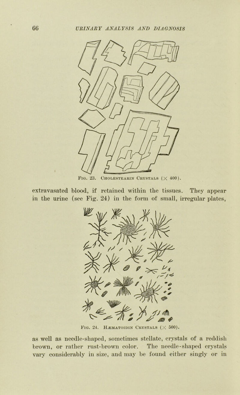 Fig. 23. Cholestearin Crystals (X 400). extravasated blood, if retained within the tissues. They appear in the urine (see Fig. 24) in the form of small, irregular plates, as well as needle-shaped, sometimes stellate, crystals of a reddish brown, or rather rust-brown color. The needle-shaped crystals vary considerably in size, and may be found either singly or in