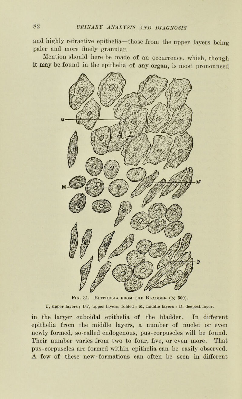 and highly refractive epithelia—those from the upper layers being paler and more finely granular. Mention should here be made of an occurrence, which, though it may be found in the epithelia of any organ, is most pronounced Fig. 31. Epithelia from the Bladder (X 500). U, upper layers ; UF, upper layers, folded ; M, middle layers ; D, deepest layer. in the larger cuboidal epithelia of the bladder. In different epithelia from the middle layers, a number of nuclei or even newly formed, so-called endogenous, pus-corpuscles will be found. Their number varies from two to four, five, or even more. That pus-corpuscles are formed within epithelia can be easily observed. A few of these new - formations can often be seen in different