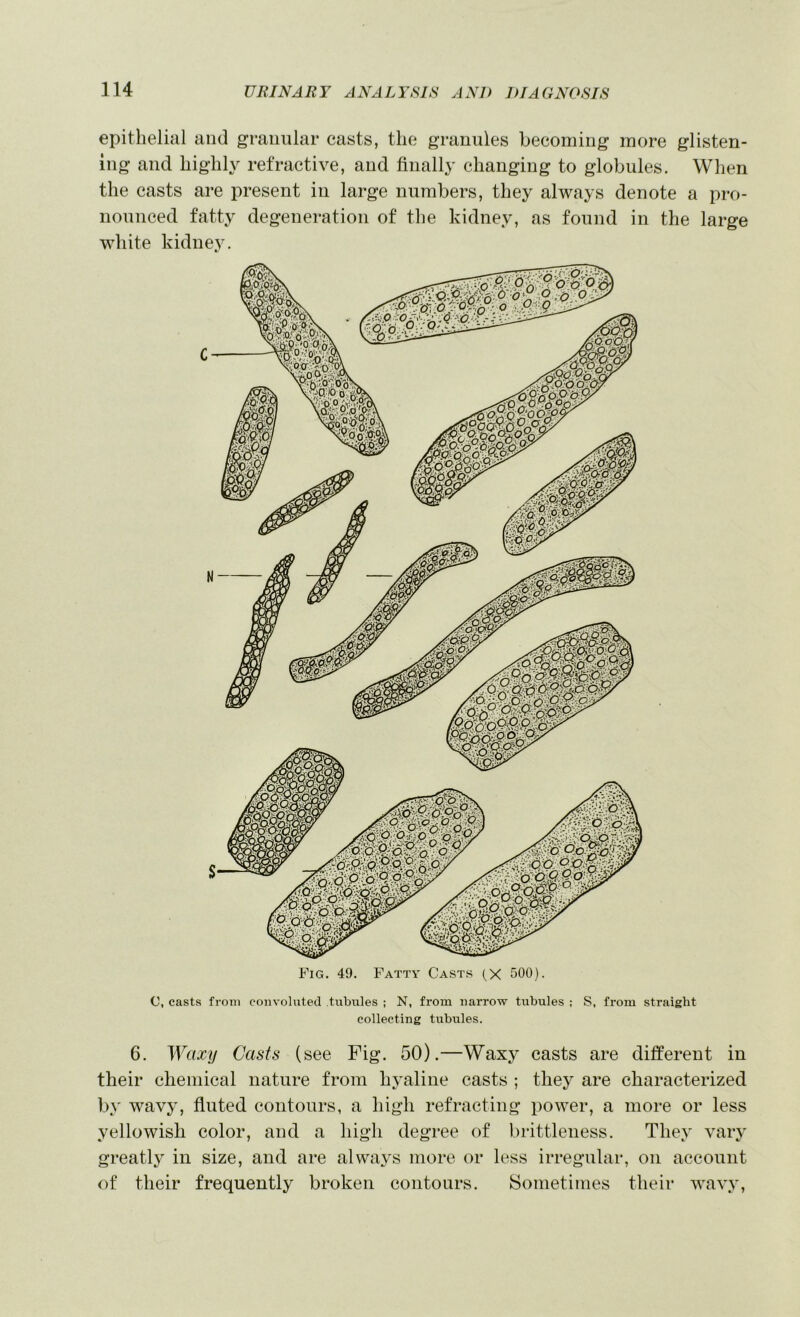 epithelial and granular casts, the granules becoming luore glisten- ing and highly refractive, and finally changing to globules. When the casts are present in large numbers, they always denote a pro- nounced fatty degeneration of the kidney, as found in the large white kidney. Fig. 49. Fatty Casts (X 500). C, casts from convoluted tubules ; N, from narrow tubules ; S, from straight collecting tubules. 6. Waxy Casts (see Fig. 50).—Waxy casts are different in their chemical nature from hyaline casts ; they are characterized by wavy, fluted contours, a high refracting power, a more or less yellowish color, and a high degree of brittleness. They vary greatly in size, and are always more or less irregular, on account of their frequently broken contours. Sometimes their wavy.