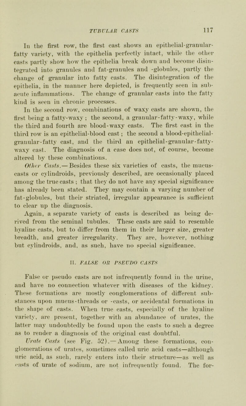 111 the first row, the first cast shows an eiiithelial-grauular- fatty variety, with the epithelia perfectly intact, while the other casts partly show how the epithelia break down and become disin- tegrated into gTannles and fat-grannies and -globnles, partly the change of grannlar into fatty casts. The disintegration of the epithelia, in the manner here depicted, is frequently seen in snb- acmte inflammations. The change of grannlar casts into the fatty kind is seen in chronic processes. In the second row, combinations of waxy casts are shown, the first being a fatty-waxy ; the second, a granular-fatty-waxy, while the third and fourth are blood-waxy casts. The first cast in the third row is an epithelial-blood cast; the second a blood-epithelial- grannlar-fatty cast, and the third an epithelial-granular-fatty- waxy cast. The diagnosis of a case does not, of course, become altered bv these combinations. €. Oihev Casts.— Besides these six varieties of casts, the mucus- casts or cylindroids, previously described, are occasionally placed among the true casts ; that they do not have any special significance has already been stated. They may contain a varying number of fat-globules, but their striated, irregular appearance is sufficient to clear up the diagnosis. Again, a separate variety of casts is described as being de- rived from the seminal tubules. These casts are said to resemble hyaline casts, but to differ from them in their larger size, greater breadth, and greater irregularity. They are, however, nothing but cylindroids, and, as such, have no special significance. II. FALSE OR PSEUDO CASTS False or pseudo casts are not infrequently found in the urine, and have no connection whatever with diseases of the kidnev. These formations are mostly conglomerations of different sub- stances upon mucus-threads or -casts, or accidental formations in the shape of casts. When true casts, especially of the hj'aline variety, are present, together with an abundance of urates, the latter may undoubtedly be found upon the casts to such a degree as to render a diagnosis of the original cast doubtful. Urate Casts (see Fig. 52).— Among these formations, con- glomerations of urates, sometimes called uric acid casts—although uric acid, as such, rarely enters into their structure—as well as casts of urate of sodium, are not infrequently found. The for-