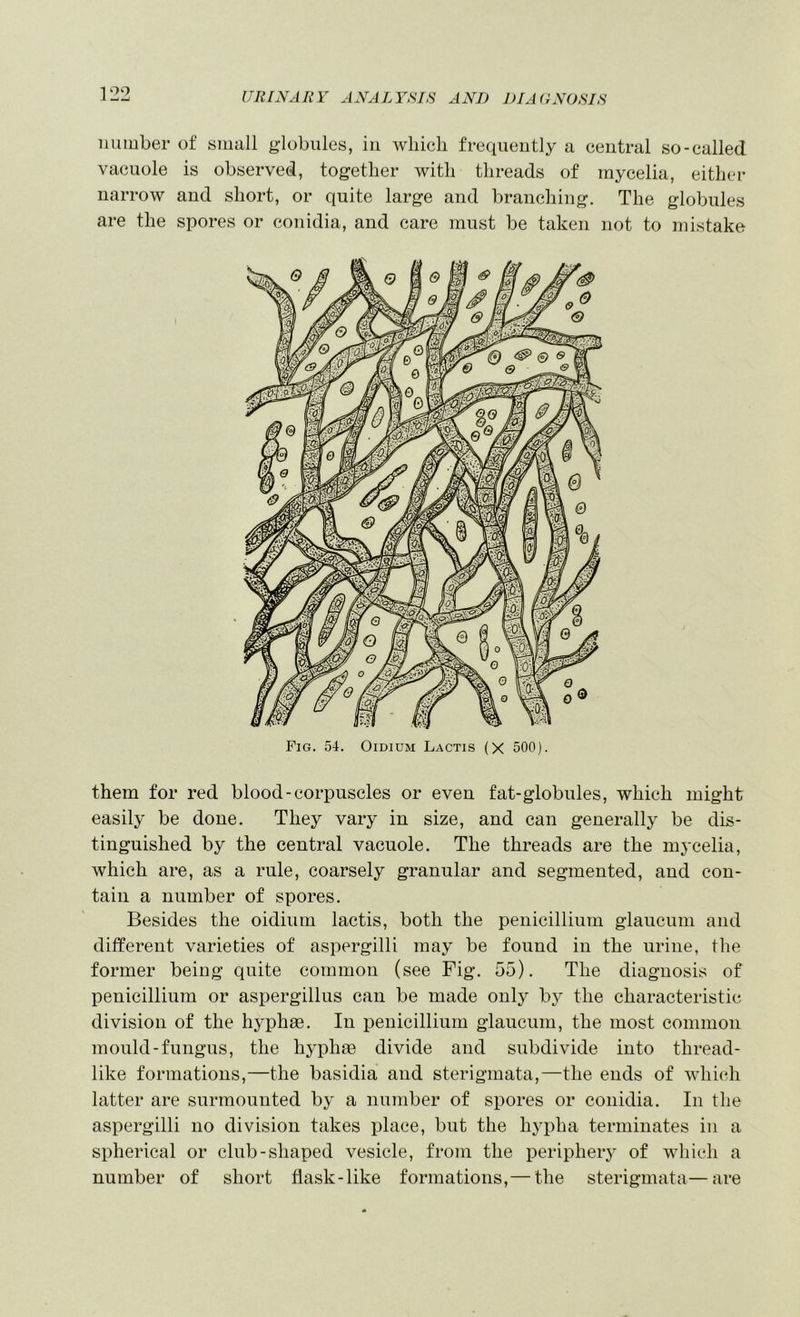 number of small globules, in which frequently a central so-called vacuole is observed, together with threads of mycelia, either narrow and short, or quite large and branching. The globules are the spores or conidia, and care must be taken not to mistake Fig. 54. Oidium Lactis (X 500). them for red blood-corpuscles or even fat-globules, which might easily be done. They vary in size, and can generally be dis- tinguished by the central vacuole. The threads are the mycelia, which are, as a rule, coarsely granular and segmented, and con- tain a number of spores. Besides the oidium lactis, both the penicillium giaucum and different varieties of aspergilli may be found in the urine, the former being quite common (see Fig. 55). The diagnosis of penicillium or aspergillus can be made only by the characteristic division of the hyphae. In penicillium giaucum, the most common mould-fungus, the hyphae divide and subdivide into thread- like formations,—the basidia and sterigmata,—the ends of which latter are surmounted by a number of spores or conidia. In the aspergilli no division takes place, but the hjq^ha terminates in a spherical or club-shaped vesicle, from the peripheiy of which a number of short flask-like formations,— the sterigmata—are