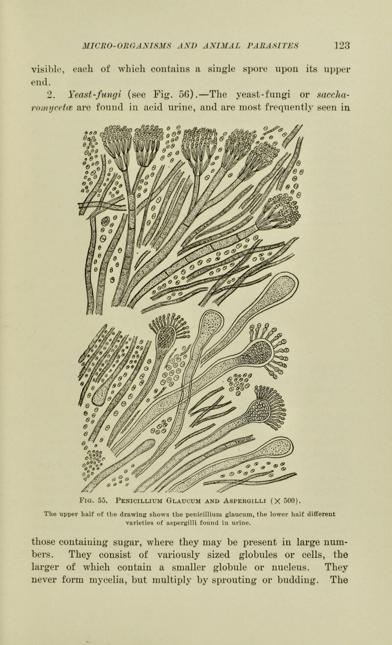 visible', each of which contains a single spore upon its upper end. 2. Yeast-fungi (see Fig. 56).—The yeast-fungi or saccha- roi)njref(e are found in acid urine, and are most frequently seen in Fig. 55. Penicillium Glaucum and Aspergilli (X 500). The upper half of the drawing shows the penicillium glaucum, the lower half different varieties of aspergilli found in urine. those containing sugar, where they may be present in large num- bers. They consist of variously sized globules or cells, the larger of which contain a smaller globule or nucleus. They never form mycelia, but multiply by sprouting or budding. The