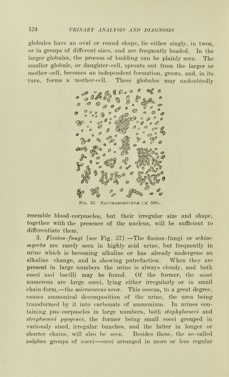 globules have an oval or round sliape, lie either singly, in twos, or ill groups of different sizes, and are frequently beaded. In the larger globules, the process of budding can be plainly seen. The smaller globule, or daughter-cell, sprouts out from the larger or mother-cell, becomes an inde])endent formation, grows, and, in its turn, forms a mother-cell. These globules may undoubtedly resemble blood-corpuscles, but their irregular size and shape, together with the presence of the nucleus, will be sufficient to differentiate them. 3. Fission-fungi (see Fig. 57).—The fission-fungi or scMzo- mgcetce are rarely seen in highly acid urine, but frequently in urine which is becoming alkaline or has already undergone an alkaline change, and is showing putrefaction. When they are present in large numbers the urine is always cloudy, and both cocci and bacilli may be found. Of the former, the most numerous are large cocci, lying either irregularly or in small chain-form,—the micrococcus urece. This coccus, to a great degree, causes ammonical decomposition of the urine, the urea being transformed by it into carbonate of ammonium. In urines con- taining pus-corpuscles in large numbers, both stitplnjiococci and streptococci j^yogenes, the former being small cocci grouped in variously sized, irregular bunches, and the latter in longer or shorter chains, will also be seen. Besides these, the so-called zoogUea groups of cocci—cocci arranged in more or less regular Fig. 56. Saccharomycet^ (X 500).