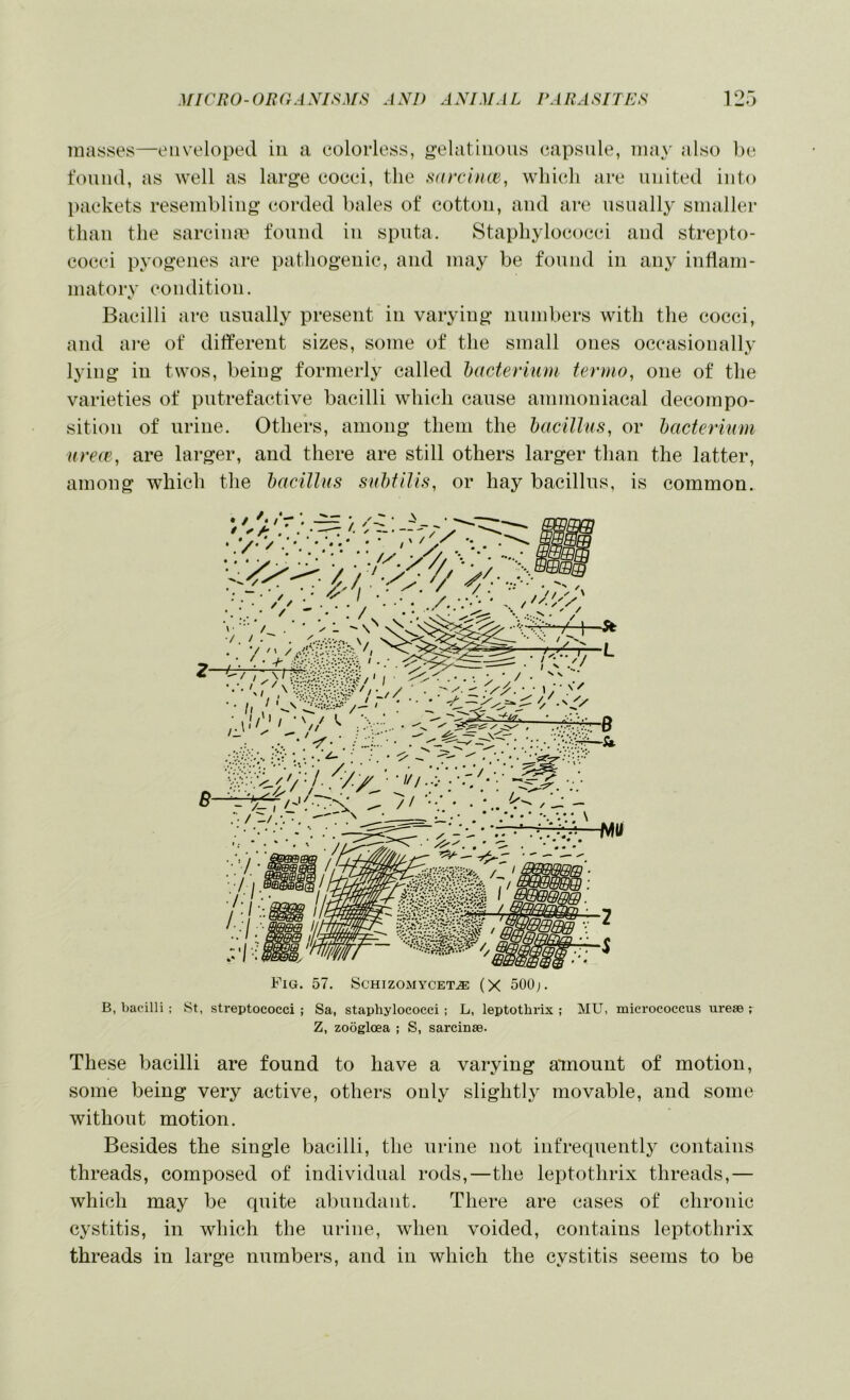 masses—enveloped in a colorless, g-elatinons capsule, may also be found, as well as large cocci, the sarcluw, which are united into packets resembling corded bales of cotton, and are usually smaller than the sareina> found in sputa. Staphylococci and strepto- cocci pyogenes are pathogenic, and may be found in any inflam- matory condition. Bacilli are usually present in varying numbers with the cocci, and ai-e of different sizes, some of the small ones occasionally lying in twos, being formerly called bacterium termo, one of the varieties of putrefactive bacilli which cause ammoniacal decompo- sition of urine. Others, among them the bacillus, or bacterium urea’, are larger, and there are still others larger than the latter, among which the bacillus subtilis, or hay bacillus, is common. B, bacilli ; St, streptococci ; Sa, staphylococci ; L, leptothrix ; MU, micrococcus ureae ; Z, zoogloea ; S, sarcinae. These bacilli are found to have a varying amount of motion, some being very active, others only slightl}^ movable, and some without motion. Besides the single bacilli, the urine not infrequentl}^ contains threads, composed of individual rods,—the leptothrix threads,— which may be quite abundant. There are cases of chronic cystitis, in which the urine, when voided, contains leptothrix threads in large numbers, and in which the cystitis seems to be