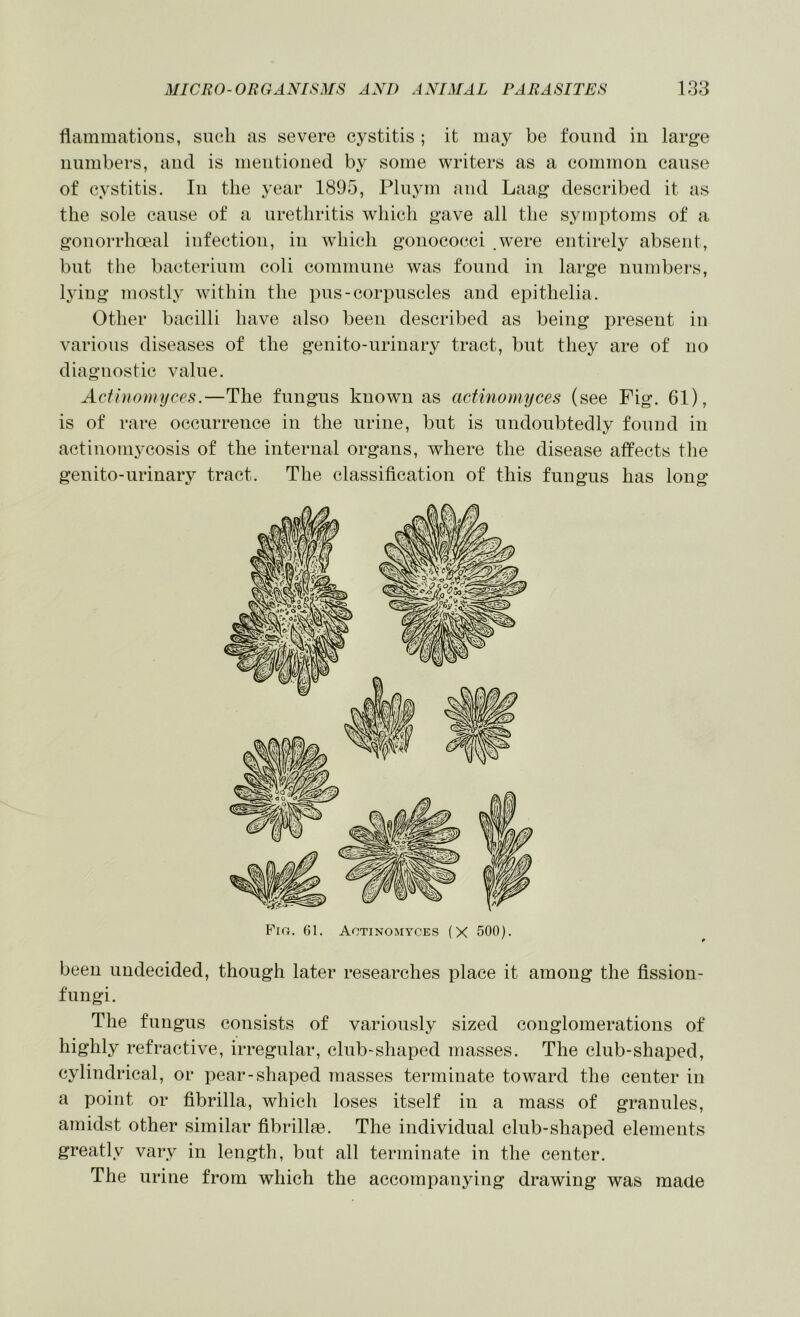 flammatioiis, sneli as severe cj^stitis ; it may be found in large numbers, and is mentioned by some writers as a common cause of cystitis. In the year 1895, Pluym and Laag described it as the sole cause of a urethritis which gave all the symptoms of a gonorrhoeal infection, in which gonococci .were entirely absent, but the bacterium coli commune was found in large numbers, lying mostly within the pus-corpuscles and epithelia. Other bacilli have also been described as being present in various diseases of the genito-urinary tract, but they are of no diagnostic value. Aci'niomijces.—The fungus known as actinonnjces (see Fig. 61), is of rare occurrence in the urine, but is undoubtedly found in actinomycosis of the internal organs, where the disease affects the genito-urinary tract. The classification of this fungus has long Pig. 61. Actinomyces (X 500). been undecided, though later researches place it among the fission- fungi. The fungus consists of variously sized conglomerations of highly refractive, irregular, club-shaped masses. The club-shaped, cylindrical, or pear-shaped masses terminate toward the center in a point or fibrilla, which loses itself in a mass of granules, amidst other similar fibrillm. The individual club-shaped elements greatly vary in length, but all terminate in the center. The urine from which the accompanying drawing was made