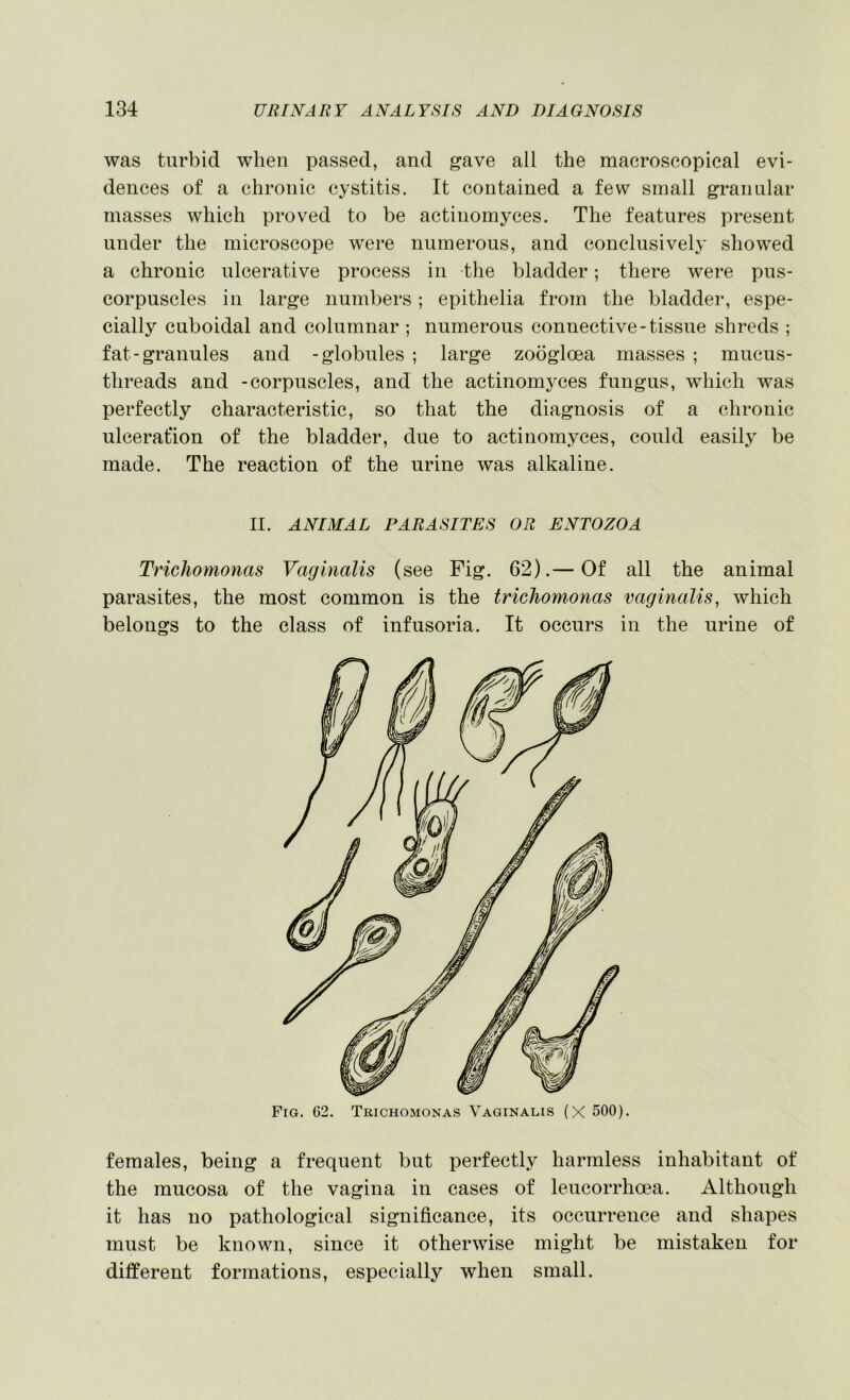 was turbid wlien passed, and gave all the macroscopieal evi- dences of a chronic cystitis. It contained a few small granular masses which proved to be actinomyces. The features present under the microscope w’ere numerous, and conclusively showed a chronic ulcerative process in the bladder; there were pus- corpuscles in large numbers ; epithelia from the bladder, espe- cially cuboidal and columnar ; numerous connective-tissue shreds ; fat-granules and -globules ; large zoogloea masses ; mucus- threads and -corpuscles, and the actinomyces fungus, which was perfectly characteristic, so that the diagnosis of a chronic ulcerafion of the bladder, due to actinomyces, could easily be made. The reaction of the urine was alkaline. II. ANIMAL PARASITES OR ENTOZOA Trichomonas Vaginalis (see Fig. 62).— Of all the animal parasites, the most common is the trichomonas vaginalis, which belongs to the class of infusoria. It occurs in the urine of Fig. 62. Trichomonas Vaginalis (X 500). females, being a frequent but perfectly harmless inhabitant of the mucosa of the vagina in cases of leucorrhoea. Although it has no pathological significance, its occurrence and shapes must be known, since it otherwise might be mistaken for different formations, especially when small.