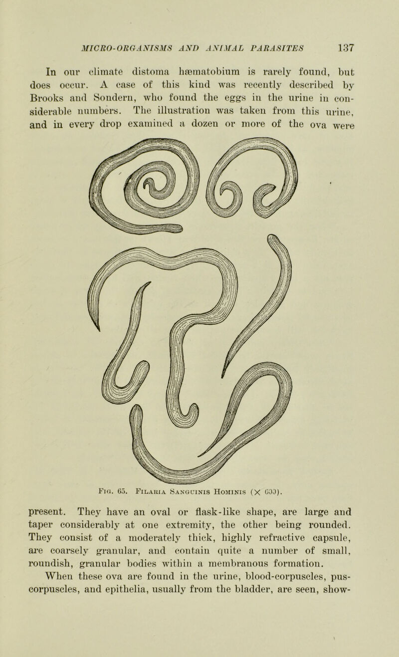 In onr climate distoma hfematobiiim is rarely found, but does occur. A case of this kiud was recently described by Brooks and Soiiderii, who found the eggs in the urine in con- siderable numbers. The illustration was taken from this urine, and in every drop examined a dozen or more of the ova were Fig. Go. Filaria Sanguinis Hominis (X GOO). present. They have an oval or flask-like shape, are large and taper considerably at one extremity, the other being rounded. They consist of a moderately thick, highly refractive capsule, ai’e coarsely granular, and contain quite a number of small, roundish, granular bodies within a membranous formation. When these ova are found in the urine, blood-corpuscles, pus- corpuscles, and epithelia, usually from the bladder, are seen, show-