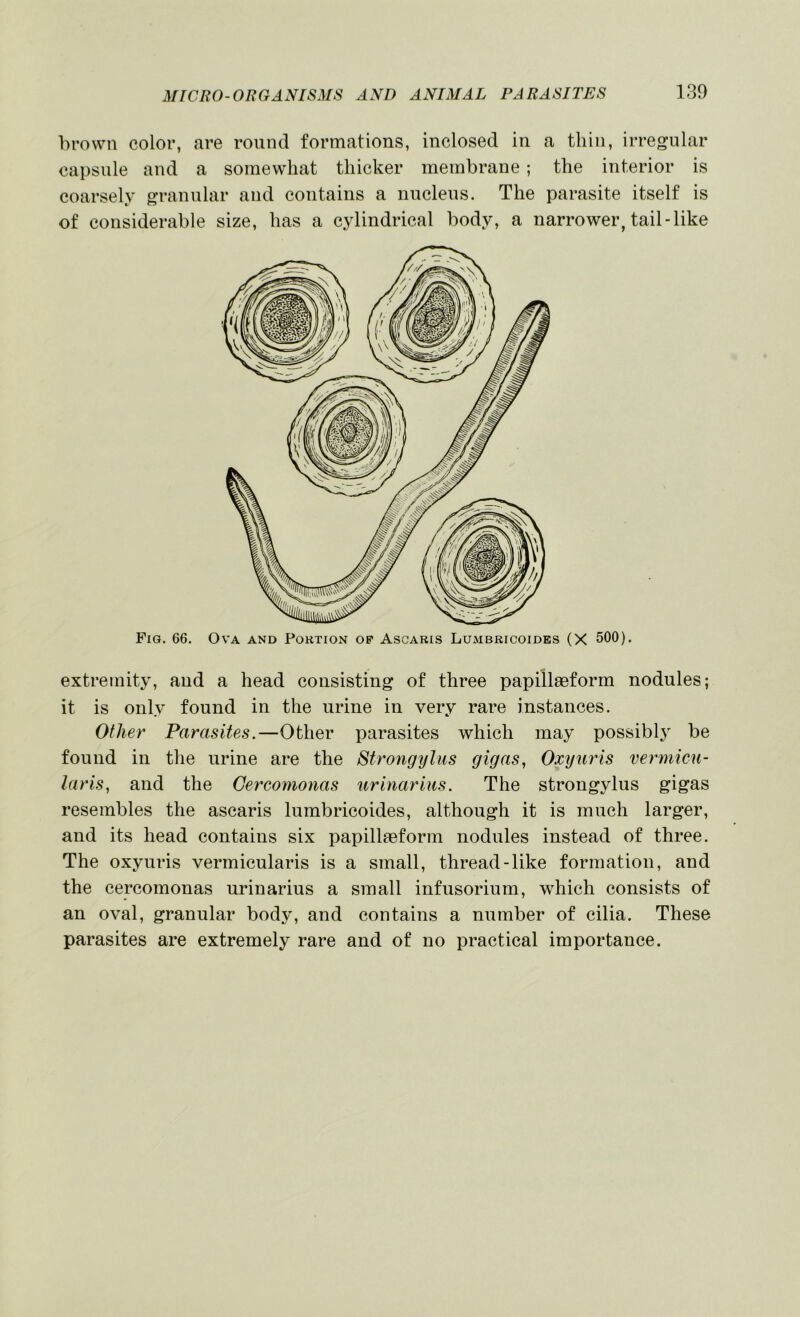 brown color, are round formations, inclosed in a thin, irregular capsule and a somewhat thicker membrane; the interior is coarsely granular and contains a nucleus. The parasite itself is of considerable size, has a cylindrical body, a narrower, tail-like Fig. 66. Ova and Portion op Ascaris Lumbricoides (X 500). extremity, and a head consisting of three papillaeform nodules; it is only found in the urine in very rare instances. Other Parasites.—Other parasites which may possibly be found in the urine are the Strongylus gigas, Oxtyuris vermicu- laris, and the Gercomonas urinarius. The strongylus gigas resembles the ascaris lumbricoides, although it is much larger, and its head contains six papillaeform nodules instead of three. The oxyuris vermicularis is a small, thread-like formation, and the cercomonas urinarius a small infusorium, which consists of an oval, granular body, and contains a number of cilia. These parasites are extremely rare and of no practical importance.