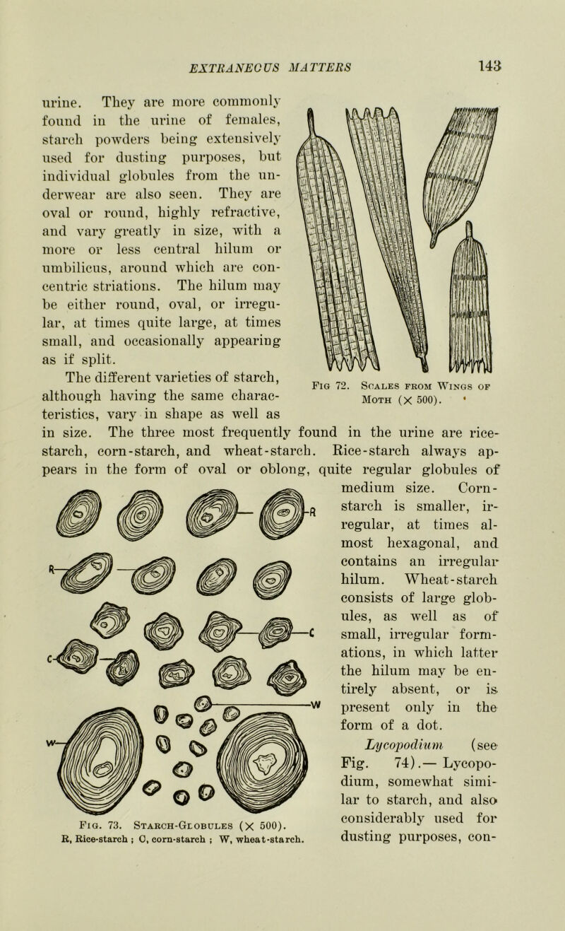 Fig 72. Scales prom Wings op Moth (X 500). * urine. They are more commonly found in the urine of females, starch powders being extensively used for dusting purposes, but individual globules from the un- derwear are also seen. They are oval or round, highly refractive, and vary greatly in size, with a more or less central hilum or umbilicus, around which are con- centric striations. The hilum may be either round, oval, or irregu- lar, at times quite large, at times small, and occasionally appearing as if split. The different varieties of starch, although having the same charac- teristics, vary in shape as well as in size. The three most frequently found in the urine are rice- starch, corn-starch, and wheat-starch. Rice-starch alwa^^s ap- pears in the form of oval or oblong, quite regular globules of medium size. Corn- starch is smaller, ir- regular, at times al- most hexagonal, and contains an irregular hilum. Wheat-starch consists of large glob- ules, as well as of small, irregular form- ations, in which latter the hilum may be en- tirely absent, or is present only in the form of a dot. Lycojjodium (see Pig. 74).— Lycopo- dium, somewhat simi- lar to starch, and also F.a. 73. Staech-Globules (x 500). Considerably used for R, Rice-starch ; C, corn-starch ; W, wheat-starch. dustillg purpOSCS, COll-