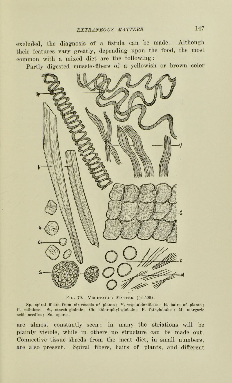 exclnded, the diagnosis of a fistula can be made. Althongh their features vary greatly, depending upon the food, the most commoii with a mixed diet are the following : Partly digested muscle-fibers of a yellowish or brown color Fig. 79. Vegetable Matter (X 500). Sp, spiral fibers from air-vessels of plants ; V, vegetable-fibers ; H, hairs of plants ; C, cellulose ; St, starch-globule ; Ch, chlorophyl-globule ; F, fat-globules ; M, margaric acid needles ; So, spores. are almost constantly seen; in many the striations will be plainly visible, while in others no structure can be made out. Connective-tissue shreds from the meat diet, in small numbers, are also present. Spiral fibers, hairs of plants, and different