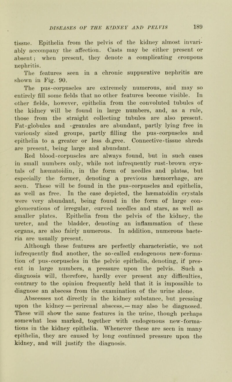 tissue. Epitlielia from the pelvis of the kidney almost invari- ably accompany the affection. Casts may be either present or absent; when present, they denote a complicating’ croupous nephritis. The features seen in a chronic suppurative nephritis are shown in Fig. 90. The pus-corpuscles are extremely numerous, and may so entirel}^ fill some fields that no other features become visible. In other fields, however, epitlielia from the convoluted tubules of the kidney will be found in large numbers, and, as a rule, those from the straight collecting tubules are also present. Fat-globules and -granules are abundant, partly lying free in variously sized groups, partly filling the pus-corpuscles and epitlielia to a greater or less degree. Connective-tissue shreds are present, being large and abundant. Red blood-corpuscles are always found, but in such cases in small numbers only, while not infrequently rust-brown crys- tals of haematoidiii, in the form of needles and plates, but especially the former, denoting a previous haemorrhage, are seen. These will be found in the pus-corpuscles and epitlielia, as well as free. In the case depicted, the haematoidiii crystals were very abundant, being found in the form of large con- glomerations of irregular, curved needles and stars, as well as smaller plates. Epitlielia from the pelvis of the kidney, the ureter, and the bladder, denoting an inflammation of these organs, are also fairly numerous. In addition, numerous bacte- ria are usually present. Although these features are perfectly characteristic, we not infrequently find another, the so-called endogenous new-forma- tion of pus-corpuscles in the pelvic epithelia, denoting, if pres- ent in large numbers, a pressure upon the pelvis. Such a diagnosis will, therefore, hardly ever present any difficulties, contrary to the opinion frequently held that it is impossible to diagnose an abscess from the examination of the urine alone. Abscesses not directly in the kidney substance, but pressing upon the kidney — perirenal abscess,— maj^ also be diagnosed. These will show the same features in the urine, though perhaps somewhat less marked, together with endogenous new-forma- tions in the kidney epithelia. Whenever these are seen in many epithelia, they are caused by long continued pressure upon the kidney, and will justify the diagnosis.