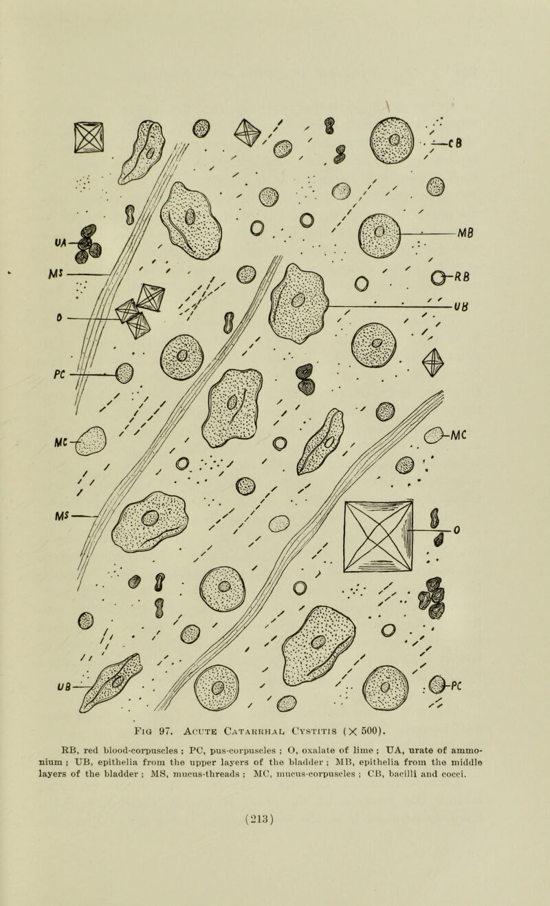 RB, red blood-corpuscles ; PC, pus-corpuscles ; O, oxalate of lime ; UA, urate of ammo- nium : UB, epithelia from the upper layers of the bladder ; !MB, eplthelia from the middle layers of the bladder ; MS, mucus-threads ; MC, mucus-corpuscles ; CB, bacilli and cocci.