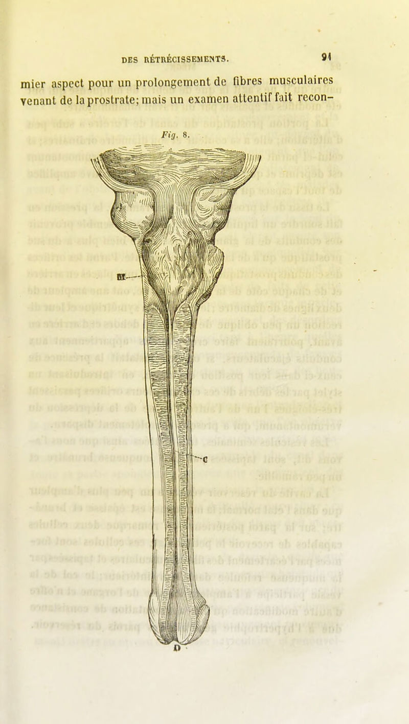 mier aspect pour un prolongement de fibres musculaires venant de la prostrate; mais un examen attentif fait recon- Fig. 8.