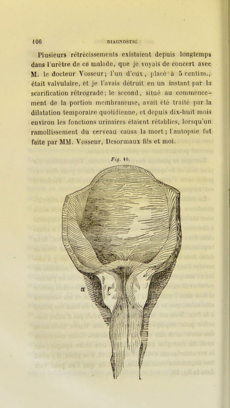 Plusieurs rétrécissements existaient depuis longtemps dans l'urètre de co malade, que je voyais de concert avec M. le docteur Vosseur; l'un d'eux, placé à 5 centim., était valvulaire, et je l'avais détruit en un instant par la scarification rétrograde; le second, situé au commence- ment de la portion membraneuse, avait été traité par la dilatation temporaire quotidienne, et depuis dix-huit mois environ les fonctions urinaires étaient rétablies, lorsqu'un ramollissement du cerveau causa la mort ; 1 autopsie fut faite par MM. Vosseur, Desormaux fils et moi.