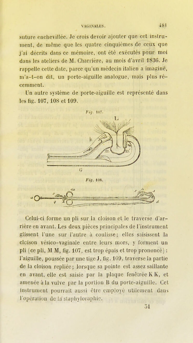 484 suture enchcvillée. Je crois devoir ajouter que cet instru- ment, de môme que les quatre cinquièmes de ceux que j'ai décrits dans ce mémoire, ont été exécutés pour moi dans les ateliers de M. Gharrièrc, au mois d'avril 1836. Je rappelle cette date, parce qu'un médecin italien a imaginé, m'a-t-on dit, un porte-aiguille analogue, mais plus ré- cemment. Un autre système de porte-aiguille est représenté dans les fig. 107,108 et 109. l<'i(). 107. G Fig. m. Celui-ci forme un pli sur la cloison et le traverse d'ar- rière en avant. Les deux pièces principales de l'instrument glissent l'une sur l'autre à coulisse; elles saisissent la cloison vésico-vaginale entre leurs mors, y forment un pli (ce pli, M M, fig. 107, est trop épais et trop prononcé) : l'aiguille, poussée par une tige J. fig. 109, traverse la partie de la cloison repliée; lorsque sa pointe est assez saillante en avant, elle est saisie par la plaque fenèlréc K K, et amenée à la vulve par la portion B du porte-aiguille. Cet instrument pourrait aussi être employé utilement dans l'opéralion de la slapliyloiapliio. 31