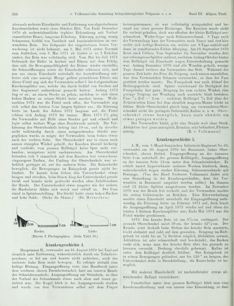 abermals mehrere Einschnitte und Entfernung von abgestorbenen Knochenstücken sowie eines Stückes Blei. Von Ende Dezember 1870 ab mehrwöchentliche typhöse Erkrankung mit Verlust sämmtlicher Haare, langsame Ei'holung. Eiterung gering, wenig Schmerzen, Gefühl von Taubheit und Ameisenkriechen im ver- wundeten Bein. Der Zeitpunkt der eingetretenen festen Ver- wachsung ist nicht bekannt, am 1. Mai 1871 erster Versuch zum Aufstehen, vom 5. Mai 1871 ab hinkte er an 2 Krücken umher, das Bein war vollständig steif. Vom Mai bis Juli 1871 Gebrauch der Bäder in Aachen und Eimen mit dem Erfolg, dass sich die Bewegungsfähigkeit des Beines wieder einstellte, die Schussöffnungen sowie die Einschnitte schlössen sich, und nur aus einem Einschnitt unterhalb der Austrittsöffnung ent- leerte sich eine massige Menge gelben geruchlosen Eiters; aus dieser Fistel zog sich der Verwundete selbst 5 bis 6 abgestorbene Knochensplitter aus, welche ihn durch Gefühl von Stechen auf ihre Gegenwart aufmerksam gemacht hatten. Anfang 1872 fing er an, an einem Stocke zu gehen, nachdem er sich einen hohen Hacken an seinen Stiefel hatte machen lassen. Weih- nachten 1872 war die Fistel noch offen, der Verwundete zog sich selbst den letzten 3cm langen Splitter aus, die Eiterung hörte im Laiife des Jahres 1872 langsam auf, die Fistel schloss sich Anfang 1873 für immer. Mitte 1873 (?) ging der Verwundete mit Hilfe eines Stockes gut und schnell und legte selbst weitere Wege ohne Beschwerde zurück. Die Ver- küi'zung des Oberschenkels betrug fast 10 cm, und da dieselbe nicht vollständig durch einen entsprechenden Stiefel aus- geglichen wurde, so neigte der Verwundete beim Gehen etwas nach der rechten Seite. Der Oberschenkel war in einem nach aussen stumpfen Winkel geheilt, der Knochen überall höckerig und verdickt, vom grossen Rollhügel keine Spur mehr vor- handen, wenigstens nicht nachzuweisen. Am Oberschenkel befanden sich 8 sämmtlich mit dem Knochen fest verwachsene eingezogene Narben, der Umfang des Oberschenkels war er- heblich geringer als auf der anderen Seite. Die Kniescheibe beweglich, die Bewegungen im Kniegelenk passiv nicht be- hindert. Er konnte beim Gehen den Unterschenkel etwas beugen und strecken, beim Sitzen hing der Unterschenkel gerade herab und konnte nicht gestreckt werden ohne Zuhilfenahme der Hände. Der Unterschenkel etwas magerer wie der andere, die Muskulatur fühlte sich weich \mä schlaff an. Der Fuss stand in Spitzfussstelluug. Der Stiefel hatte einen hohen Hacken und hohe Sohle. (Siehe die Skizze.) (Dr. Heinecken.) Rechts. Liiik.'^. (Tfierzu 2 Photographien. Siehe Tafel 30.) Kraiikeiigescliiclite 4, Hauptmann H., verwundet am 1(5. August 1870 bei Toul auf ziemlich nahe Entfernung, wahrscheinlich durch ein Tabatiei-e- geschoss; er fiel um und konnte nicht aufstehen, auch das verletzte linke Bein nicht bewegen. Es erfolgte alsbald eine heftige Blutung. Eingangsöft'nung vorn eine Handbreit unter dem vorderen oberen Darmbeinstachel, hart am inneren Rande des Schneidermuskels; Ausgaugsöffnung am Steissbein, so dass der Verlauf des Schusskanals etwas nach oben und innen ge- richtet war. Die Kugel blieb in der Ausgangswunde stecken ixnd wurde von dem Verwundeten selbst mit dem P^inger herausgenommen; sie war vollständig missgestaltet und be- stand aus einer grossen Bleimenge. Der Knochen wurde nicht für verletzt gehalten, doch war offenbar der kleine Rollhügel zer- schmettert. Weder Gyps- noch Schienenverband. 8 Tage nach der Verwundung kam der Verwundete nach Nancy und er.st hier stellte sich heftige Reaktion ein, welche nur 8 Tage anhielt und , dann in remittireudes Fieber überging. Am 18. September 1870 Reise nach C'ötheii. Vom September his November wurden drei nur erbsengrosse Splitter entfernt, nachdem Anfang Oktober hinter dem Rollhügel ein Einschnitt wegen Eiterverhaltung gemacht war. Anfang Dezember 1870 sind alle Wunden geheilt, wenige Tage darauf verliess der Verwundete das Bett. Während der ganzen Zeit hatte der Fuss die Neigung, nach aussen umzufallen, was dem Verwundeten Schmerz verursachte, so dass der Fuss gestützt werden musste. Das Fussgelenk war nach Ablauf der Heilungsperiode steif. Später verschwand die Steifigkeit des Fussgelenks fast ganz, Beugung bis zum rechten Winkel, eine geringe Neigung zur Wendung nach auswärts blieb bestehen. Fuss Zoll — 2 cm -- verkürzt, Rollhügel ^4 Zoll über der Nelaton'schen Linie bei dem ziemlich mageren Manne leicht zu fühlen. Beide Oberschenkel gleich lang, am verwundeten Ober- schenkel nicht die geringste Deformität, Kallus u. s. w. Ober- schenkel etwas beweglich, kann nach abwärts um etwas gezogen werden. Der Verwundete hinkt, geht eine Stunde weit ohne Stock. Abduktion fast ganz unmöglich, Rotation sehr behindert, Flexion massig. (R. v. Volk mann.) Krankeiigesfhiclite 5. A. M., vom 3. Magdeburgischen Infanterie-Regiment No. 66, verwundet am 30. August 1870 bei Beaumont, linker Ober- schenkel, oberes Drittel. Eingangsöfifuung an der äusserten Seite 5 cm untei'halb des grossen Rollhügels; Ausgangsöffnung an der inneren Seite 12 cm unter dem Schambeinhöcker. Er erhielt zuerst Gypsverbände mehrere Wochen hindurch, dann, wahrscheinlich wegen starker Eiterung, Schienenverbände mit Drainage. (Von der Hand Professor Volkmanirs findet sich eine Bemerkung in der Krankengeschichte, dass der Ver- wundete in Beaumont amputirt werden sollte.) Im Ganzen sind 12 kleine Splitter ausgestossen worden. Im November 1870 war der Bruch fest verheilt, und der Verwundete machte die ersten Gehversuche an Krücken. Eine Eiterverhaltung machte einen Einschnitt unterhalb der Eingaugsöffuung noth- wendig, die Eiterung hörte im Februar 1871 auf, doch brach die Ausgaugsöffnung im April 1873 wieder auf und stiess die letzten 4 kleinen Knochensplitter aus; Ende Mai 1873 war die Fistel wieder geschlossen. 1873: Das kranke Bein ist um 3'/-'cm verlängert. Der gesunde Oberschenkel misst 39 cm, der kranke 42'2 cm. Der Kranke setzt deshalb beim Stehen das kranke Bein auswärts, leicht abduzirt und ruht auf dem gesunden. Beugung im Hüft- gelenk ist nicht bis zu V2 Rechten möglich, Abduktion normal, Adduktion ist sehr schmerzhaft und beschränkt, das Becken senkt sich, wenn man das kranke Bein über das gesunde zu kreuzen versucht. Drehung ebenfalls gehemmt. Kallus ist unter dem Rollhügel deutlich fülilbar. Das Kniegelenk ist in seinen Bewegungen gehindert, nur bis 120  zu beugen, der Unterschenkel steht in Streckstellung, die Kniescheibe ist be- weglich. Mit anderer Handschrift ist nachstehender etwas ab- weichender Befund verzeichnet: Unmittelbar unter dem grossen Rollhügel fühlt man eine Knocheuauftreibung und von aussen eine Einsenkung, so dass