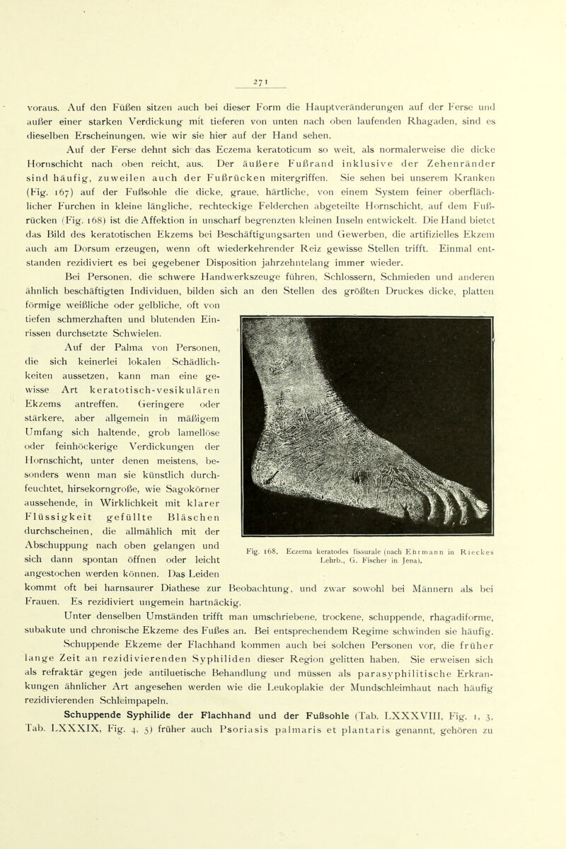voraus. Auf den Füßen sitzen auch bei dieser Form die Hauptveränderungen auf der Ferse und außer einer starken Verdickung mit tieferen von unten nach oben laufenden Rhagaden, sind es dieselben Erscheinungen, wie wir sie hier auf der Hand sehen. Auf der Ferse dehnt sich' das Eczema keratoticum so weit, als normalerweise die dicke Hornschicht nach oben reicht, aus. Der äußere Fußrand inklusive der Zehenränder sind häufig, zuweilen auch der Fußrücken mitergriffen. Sie sehen bei unserem Kranken (Fig. 167) auf der Fußsohle die dicke, graue, härtliche, von einem System feiner oberfläch- licher Furchen in kleine längliche, rechteckige Felderchen abgeteilte Hornschicht, auf dem Fuß- rücken (Fig. 168) ist die Affektion in unscharf begrenzten kleinen Inseln entwickelt. Die Hand bietet das Bild des keratotischen Ekzems bei Beschäftigungsarten und Gewerben, die artifizielles Ekzem auch am Dersum erzeugen, wenn oft wiederkehrender Reiz gewisse Stellen trifft. Einmal ent- standen rezidiviert es bei gegebener Disposition jahrzehntelang immer wieder. Bei Personen, die schwere Handwerkszeuge führen, Schlossern, Schmieden und anderen ähnlich beschäftigten Individuen, bilden sich an den Stellen des größten Druckes dicke, platten förmige weißliche oder gelbliche, oft von tiefen schmerzhaften und blutenden Ein- rissen durchsetzte Schwielen. Auf der Palma von Personen, die sich keinerlei lokalen Schädlich- keiten aussetzen, kann man eine ge- wisse Art keratotisch-vesikulären Ekzems antreffen. Geringere oder stärkere, aber allgemein in mäßigem Umfang sich haltende, grob lamellöse oder feinhöckerige Verdickungen der Hornschicht, unter denen meistens, be- sonders wenn man sie künstlich durch- feuchtet, hirsekorngroße, wie Sagokörner aussehende, in Wirklichkeit mit klarer Flüssigkeit gefüllte Bläschen durchscheinen, die allmählich mit der Abschuppung nach oben gelangen und sich dann spontan öffnen oder leicht angestochen werden können. Das Leiden kommt oft bei harnsaurer Diathese zur Beobachtung, und zwar sowohl bei Männern als bei Frauen. Es rezidiviert ungemein hartnäckig. Unter denselben Umständen trifft man umschriebene, trockene, schuppende, rhagadiforme, subakute und chronische Ekzeme des Fußes an. Bei entsprechendem Regime schwinden sie häufig. Schuppende Ekzeme der Flachhand kommen auch bei solchen Personen vor, die früher lange Zeit an rezidivierenden Syphiliden dieser Region gelitten haben. Sie erweisen sich als refraktär gegen jede antiluetische Behandlung und müssen als parasyphilitische Erkran- kungen ähnlicher Art angesehen werden wie die Leukoplakie der Mundschleimhaut nach häufig rezidivierenden Schleimpapeln. Schuppende Syphilide der Flachhand und der Fußsohle (Tab. LXXXVIII, Fig. i, 3, Tab. LXXXIX, Fig. 4, 5) früher auch Psoriasis palmaris et plantaris genannt, gehören zu