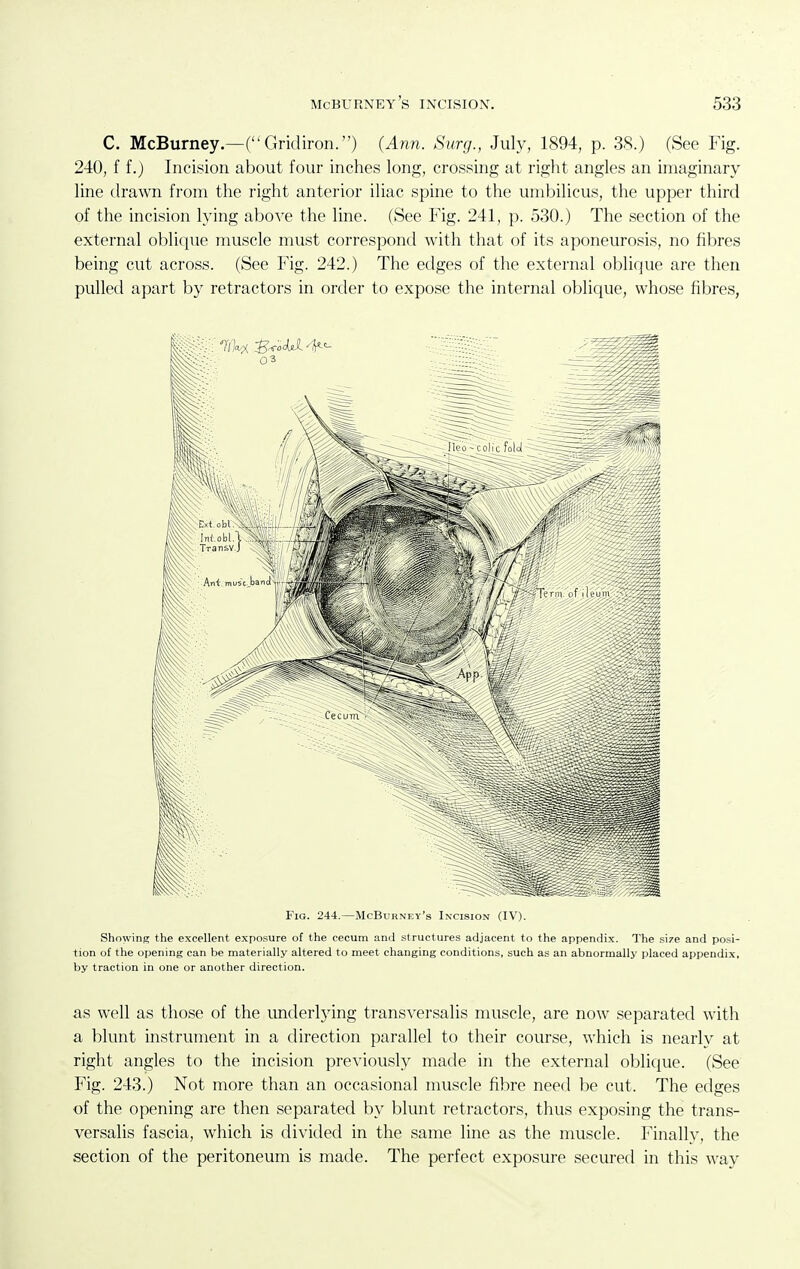 C. McBurney.—(Gridiron.) (Ann. Surg., July, 1894, p. 38.) (See Fig. 240, f f.) Incision about four inches long, crossing at right angles an imaginary line drawn from the right anterior iliac spine to the umbilicus, the upper third of the incision lying above the line. (See Fig. 241, p. 530.) The section of the external oblique muscle must correspond with that of its aponeurosis, no fibres being cut across. (See Fig. 242.) The edges of the external oblique are then pulled apart by retractors in order to expose the internal oblique, whose fibres, Fig. 244.—McBurney's Incision (IV). Showing the excellent exposure of the cecum and structures adjacent to the appendix. The size and posi- tion of the opening can be materially altered to meet changing conditions, such as an abnormally placed appendix, by traction in one or another direction. as well as those of the imderlying transversalis muscle, are now separated with a blunt instrument in a direction parallel to their course, which is nearlv at right angles to the incision previously made in the external oblique. (See Fig. 243.) Not more than an occasional muscle fibre need be cut. The edges of the opening are then separated by blunt retractors, thus exposing the trans- versalis fascia, which is divided in the same line as the muscle. Finally, the section of the peritoneum is made. The perfect exposure secured in this way