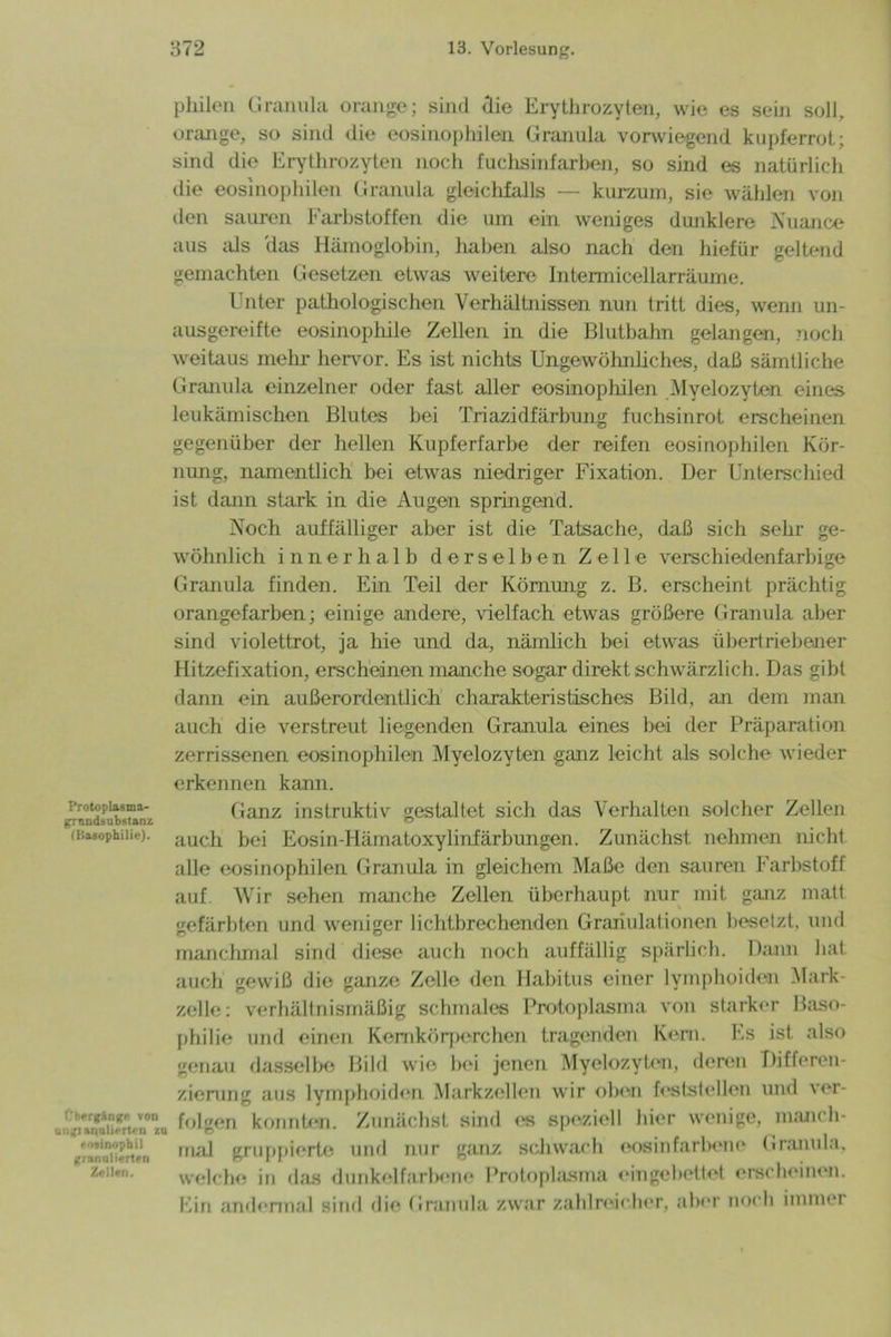 Protoplasma- grnndäubstanz (Basophilie). Pbtrgkngi- von uiiitiannliortrn z »itinophil gianiilierttn Zellen. philen Granula orange; sind die Erythrozyten, wie es sein soll, orange, so sind die eosinophilen Granula vorwiegend kupferrot; sind die Erythrozyten noch fuchsinfarhen, so sind es natürlich die eosinophilen Granula gleichfalls — kurzum, sie wählen von den sauren Farbstoffen die um ein weniges dunklere Nuance aus als das Hämoglobin, haben also nach den hiefür geltend gemachten Gesetzen etwas weitere Intermicellarräume. Unter pathologischen Verhältnissen nun tritt dies, wenn un- ausgereifte eosinophile Zellen in die Blutbahn gelangen, noch weitaus mehr hervor. Es ist nichts Ungewöhnliches, daß sämtliche Granula einzelner oder fast aller eosinophilen Myelozyten eines leukämischen Blutes bei Triazidfärbung fuchsinrot erscheinen gegenüber der hellen Kupferfarbe der reifen eosinophilen Kör- nung, namentlich bei etwas niedriger Fixation. Der Unterschied ist dann stark in die Augen springend. Noch auffälliger aber ist die Tatsache, daß sich sehr ge- wöhnlich innerhalb derselben Zelle verschiedenfarbige Granula finden. Ein Teil der Körnung z. B. erscheint prächtig orangefarben; einige andere, vielfach etwas größere Granula aber sind violettrot, ja hie und da, nämlich bei etwas übertriebener Hitzefixation, erscheinen manche sogar direkt schwärzlich. Das gibt dann ein außerordentlich charakteristisches Bild, an dem man auch die verstreut liegenden Granula eines bei der Präparation zerrissenen eosinophilen Myelozyten ganz leicht als solche wieder erkennen kann. Ganz instruktiv gestaltet sich das Verhalten solcher Zellen auch bei Eosin-Hämatoxylinfärbungen. Zunächst nehmen nicht alle eosinophilen Granula in gleichem Maße den sauren Farbstoff auf. Wir sehen manche Zellen überhaupt nur mit ganz matt gefärbten und weniger lichtbrechenden Granulationen besetzt, und manchmal sind diese auch noch auffällig spärlich. Dann hat auch gewiß die ganze Zelle den Habitus einer lvmphoiden Mark- zelle: verhältnismäßig schmales Protoplasma von starker Baso- philie und einen Kemkörperchen tragenden Kern. Es ist also genau dasselbe Bild wie bei jenen Myelozyten, deren Differen- zierung aus lymphoiden Markzellen wir oben feststellen und ver- folgen konnten. Zunächst sind ('s speziell hier wenige, manch- mal gruppierte und nur g.'inz schwach eosinfarbene Granula, welche in das dunkelfarlxme Protoplasma eingebettet erscheinen. Ein andermal sind die Granula zwar zahlreicher, aber noch immei