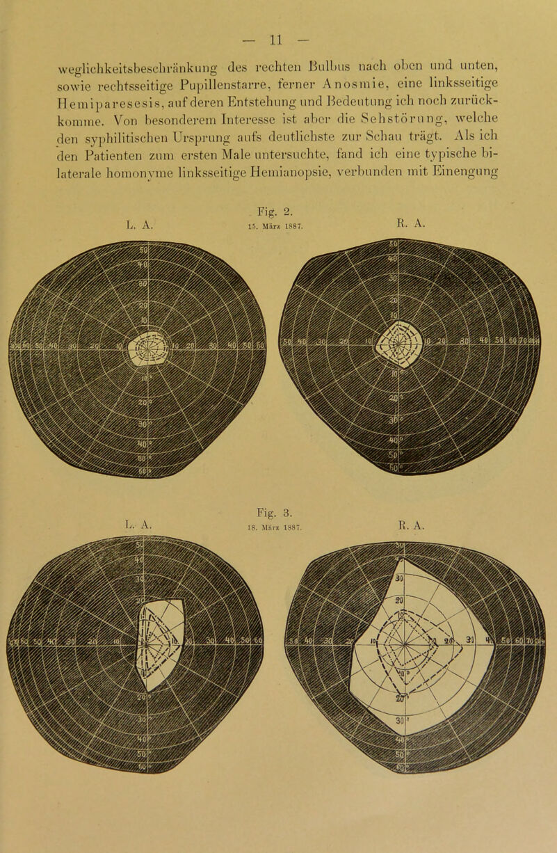 weglichkeitsbeschränkung des rechten Bulbus nach oben und unten, sowie rechtsseitige Pupillenstarre, ferner Anosmie, eine linksseitige Hemiparesesis, auf deren Entstehung und Bedeutung ich noch zurück- konnne. Von besonderem Interesse ist aber die Sehstörung, welche den syphilitischen Ursprung aufs deutlichste zur Schau trägt. Als ich den Patienten zum ersten Male untersuchte, fand ich eine typische bi- laterale homonyme linksseitige Hemianopsie, verbunden mit Einengung L. A. In. Mär* 1887. R. A. Fig. 3. 18. llär* 1887.