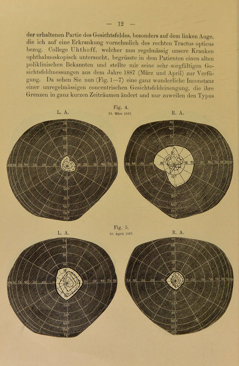 der erhaltenen Partie des Gesichtsfeldes, besonders auf dem linken Auge, die ich auf eine Erkrankung vornehmlich des rechten Tractus opticus bezog. College Uhthoff, welcher nun regelmässig unsere Kranken ophthalmoskopisch untersucht, begrüsste in dem Patienten einen alten poliklinischen Bekannten und stellte mir seine sehr sorgfältigen Ge- sichtsfeldmessungen aus dem Jahre 1887 (März und April) zur Verfü- gung. Da sehen Sie nun (Fig. 1—7) eine ganz wunderliche Inconstanz einer unregelmässigen concentrischen Gesichtsfeldeinengung, die ihre Grenzen in ganz kurzen Zeiträumen ändert und nur zuweilen den Typus L. A. Fig. 5. 10. April 1887.