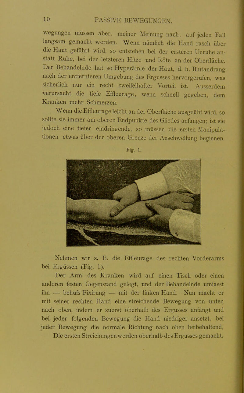 wegungen müssen aber, meiner Meinung nach, auf jeden Fall langsam gemacht werden. Wenn nämlich die Hand rasch über die Haut geführt wird, so entstehen bei der ersteren Unruhe an- statt Ruhe, bei der letzteren Hitze und Röte an der Oberfläche. Der Behandelnde hat so Hyperämie der Haut, d. h. Blutandrang nach der entfernteren Umgebung des Ergusses hervorgerufen, was sicherhch nur ein recht zweifelhafter Vorteil ist. Ausserdem verursacht die tiefe Effleurage, wenn schnell gegeben, dem Kranken mehr Schmerzen. Wenn die Effleurage leicht an der Oberfläche ausgeübt wird, so sollte sie immer am oberen Endpunkte des Gliedes anfangen; ist sie jedoch eine tiefer eindringende, so müssen die ersten Manipula- tionen etwas über der oberen Grenze der Anschwellung beginnen. Fig. 1. Nehmen wir z. B. die Effleurage des rechten Vorderarms bei Ergüssen (Fig. 1). Der Arm des Kranken wird auf einen Tisch oder einen anderen festen Gegenstand gelegt, und der Behandelnde umfasst ihn — behufs Fixirung — mit der linken Hand. Nun macht er mit seiner rechten Hand eine streichende Bewegung von unten nach oben, indem er zuerst oberhalb des Ergusses anfängt und bei jeder folgenden Bewegung die Hand niedriger ansetzt, bei jeder Bewegung die normale Richtung nach oben beibehaltend. Die ersten Streichungen werden oberhalb des Ergusses gemacht.