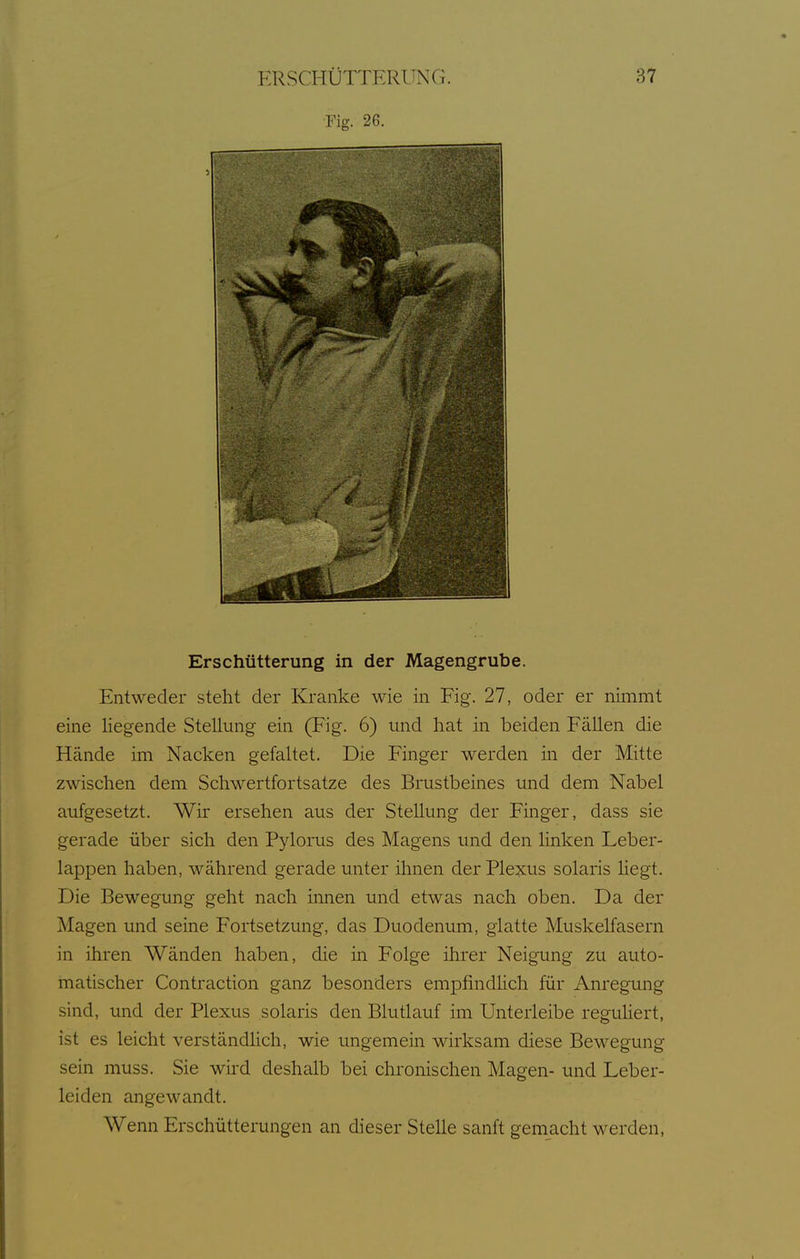 Fig. 26. Erschütterung in der Magengrube. Entweder steht der Kranke wie in Fig. 27, oder er nimmt eine Hegende Stellung ein (Fig. 6) und hat in beiden Fällen die Hände im Nacken gefaltet. Die Finger werden in der Mitte zwischen dem Schwertfortsatze des Brustbeines und dem Nabel aufgesetzt. Wir ersehen aus der Stellung der Finger, dass sie gerade über sich den Pylorus des Magens und den linken Leber- lappen haben, während gerade unter ihnen der Plexus solaris hegt. Die Bewegung geht nach innen und etwas nach oben. Da der Magen und seine Fortsetzung, das Duodenum, glatte Muskelfasern in ihren Wänden haben, die in Folge ihrer Neigung zu auto- matischer Contraction ganz besonders empfindhch für Anregung sind, und der Plexus solaris den Blutlauf im Unterleibe reguHert, ist es leicht verständlich, wie ungemein wkksam diese Bewegung sein muss. Sie wird deshalb bei chronischen Magen- und Leber- leiden angewandt. Wenn Erschütterungen an dieser Stelle sanft gemacht werden,