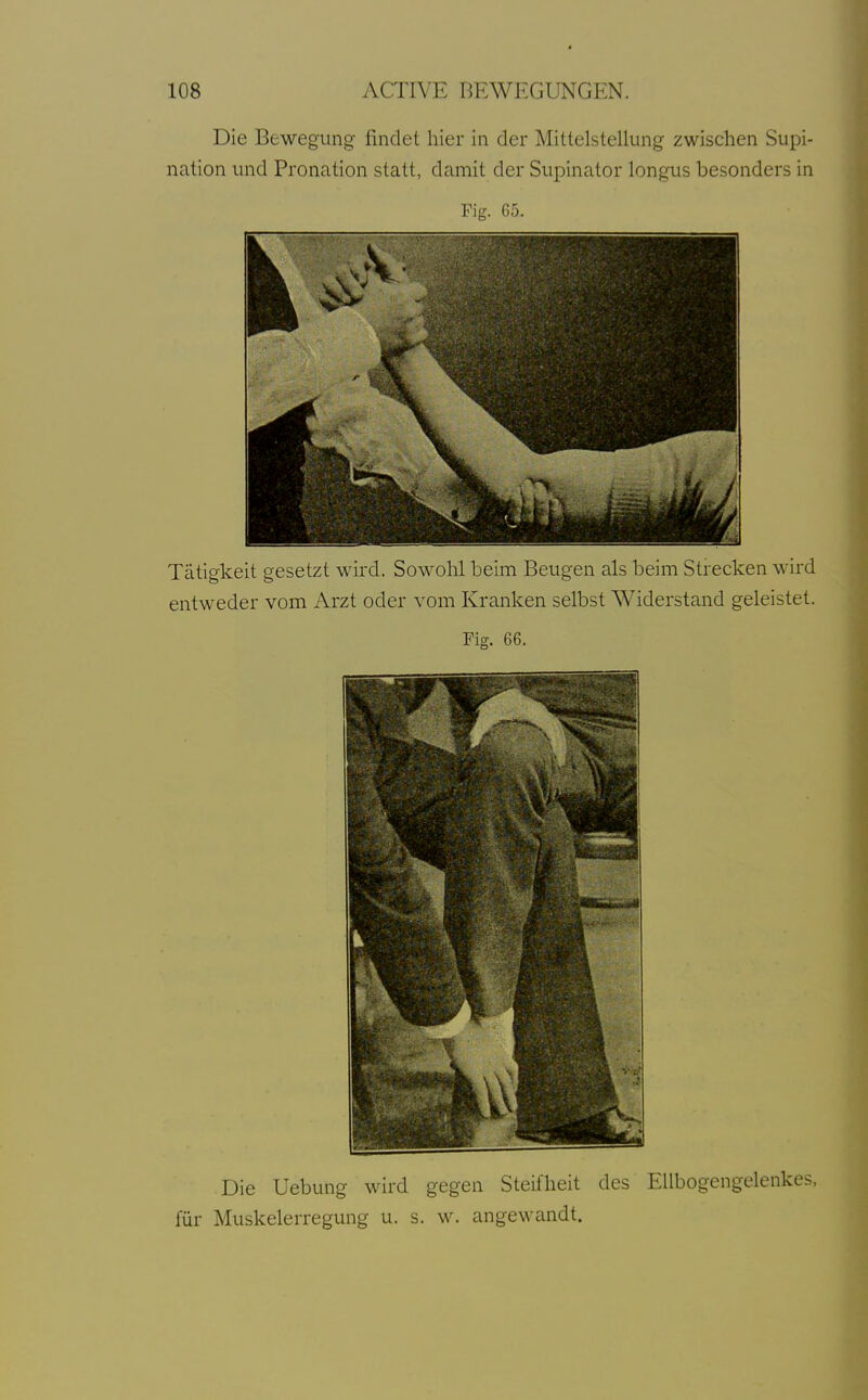 Die Bewegung findet hier in der Mittelstellung zwischen Supi- nation und Pronation statt, damit der Supinator longus besonders in Fig. 65. Tätigkeit gesetzt wird. Sowohl beim Beugen als beim Strecken wird entweder vom Arzt oder vom Kranken selbst Widerstand geleistet. Fig. 66. Die Uebung wird gegen Steifheit des Ellbogengelenkes, für Muskelerregung u. s. w. angcM'andt.