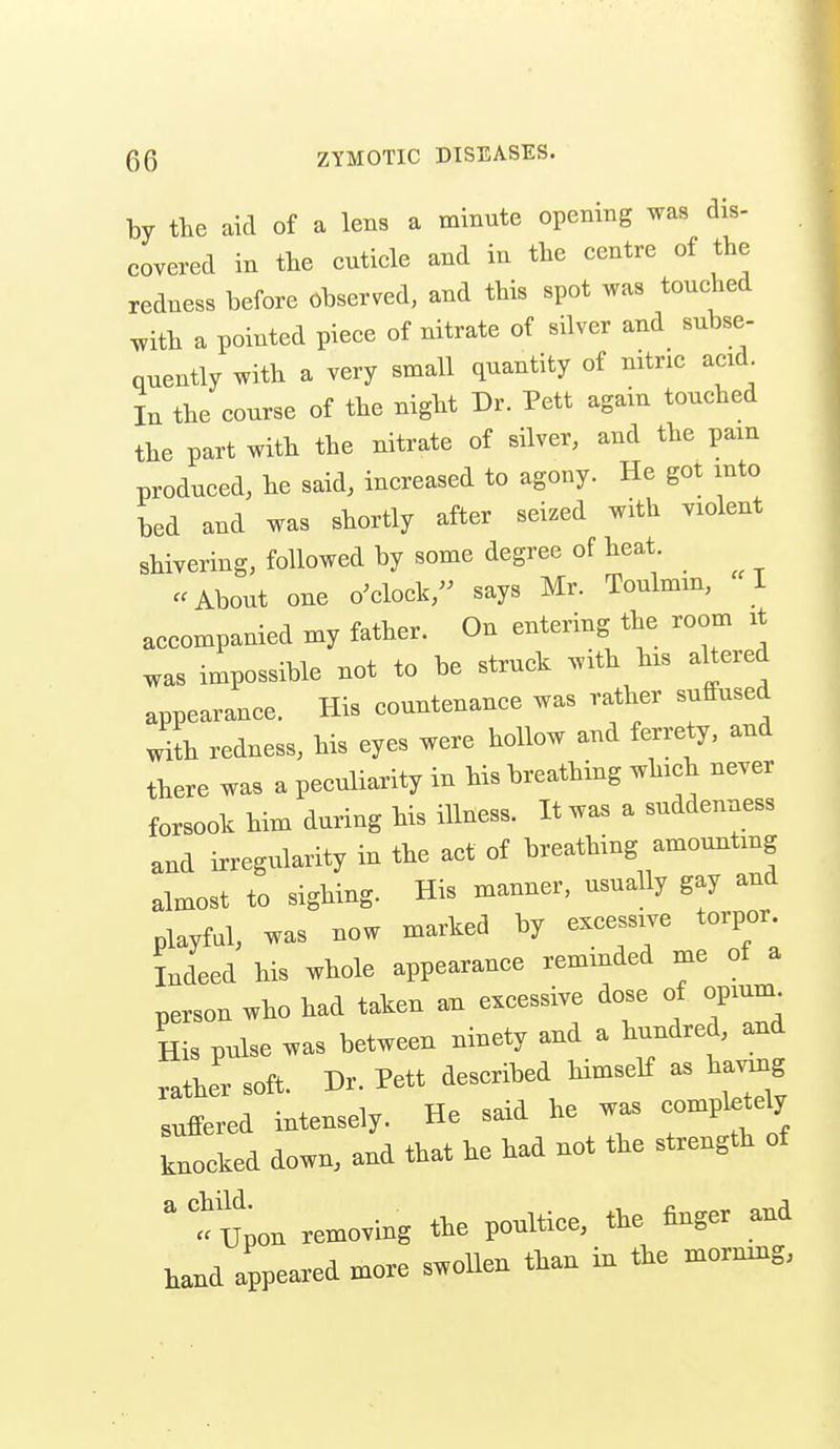 by tte aid of a lens a minute opening was dis- covered in the euticle and in the centre of the redness before observed, and this spot was touched with a pointed piece of nitrate of silver and subse- nuently with a very small quantity of nitric acid In the course of the night Dr. Pett again touched the part with the nitrate of silver, and the pam produced, he said, increased to agony. He got into bed and was shortly after seized with violent shivering, followed by some degree of heat «About one o'clock, says Mr. Toulmm, I accompanied my father. On entering the room xt was impossible not to be struck with his altered appearance. His countenance was rather suffused with redness, his eyes were hollow and ferrety, and there was a peculiarity in his breathing which never forsook him during his illness. It was a suddenness and irregularity in the act of breathing amounting almost to sighing. His manner, usually gay and playful, was now marked by excessive torpor, indeed his whole appearance reminded me of a person who had taken an excessive dose of opiunu His pulse was between ninety and a hundred, and rather soft. Dr. Pett described himself as having suffered intensely. He said he was completely knocked down, and that he had not the strength of ' t Upon removing the poultice, the finger and hand appeared more swoUen than in the morning,